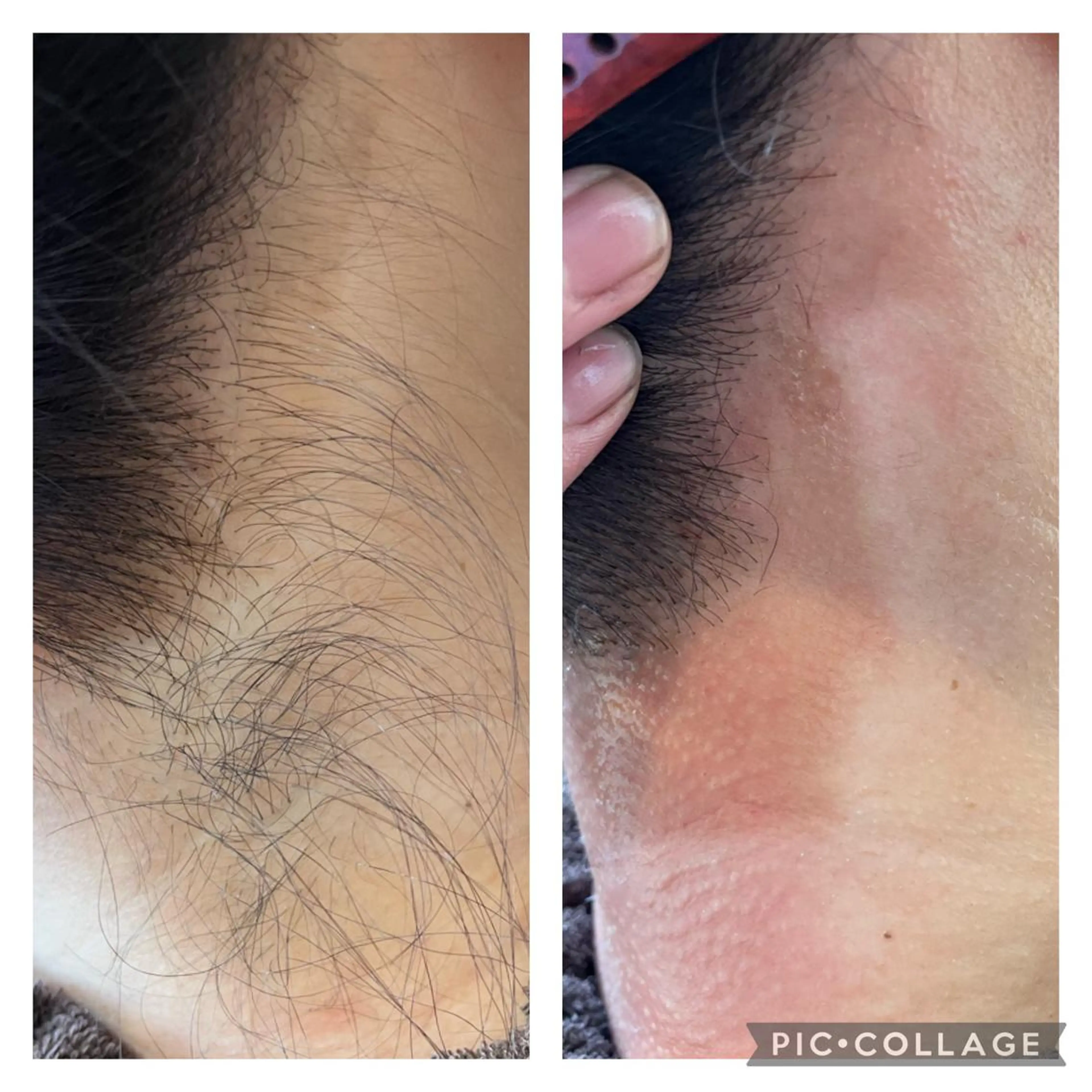 ネイル マツエク・マツパ アイブロウ 眉毛ワックス脱毛 total beauty  salon RIRE所属・古川 弥生のエステ・リラクイメージ