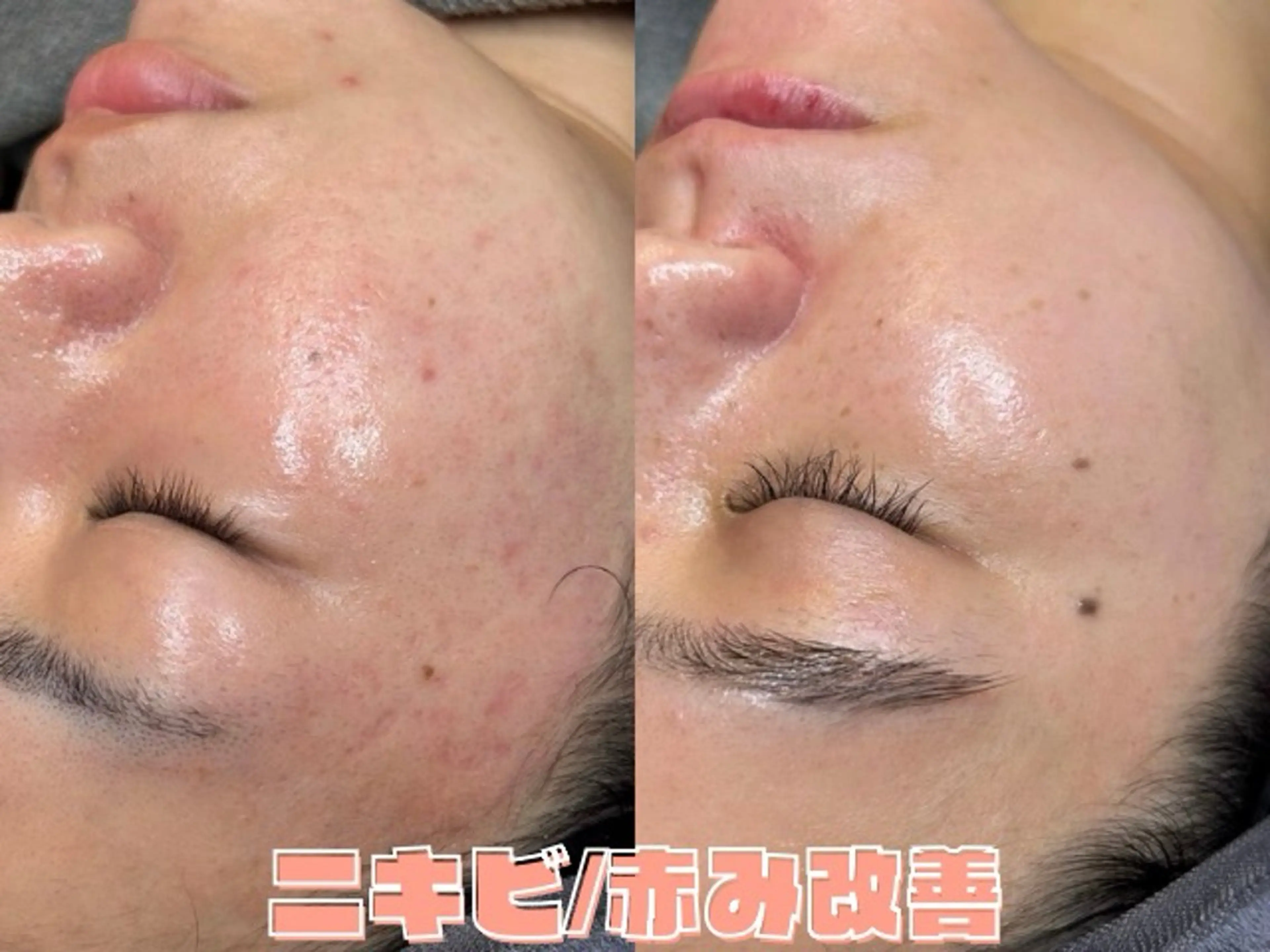 韓国肌管理ララピール クリスタルビューティのエステ・リラクイメージ