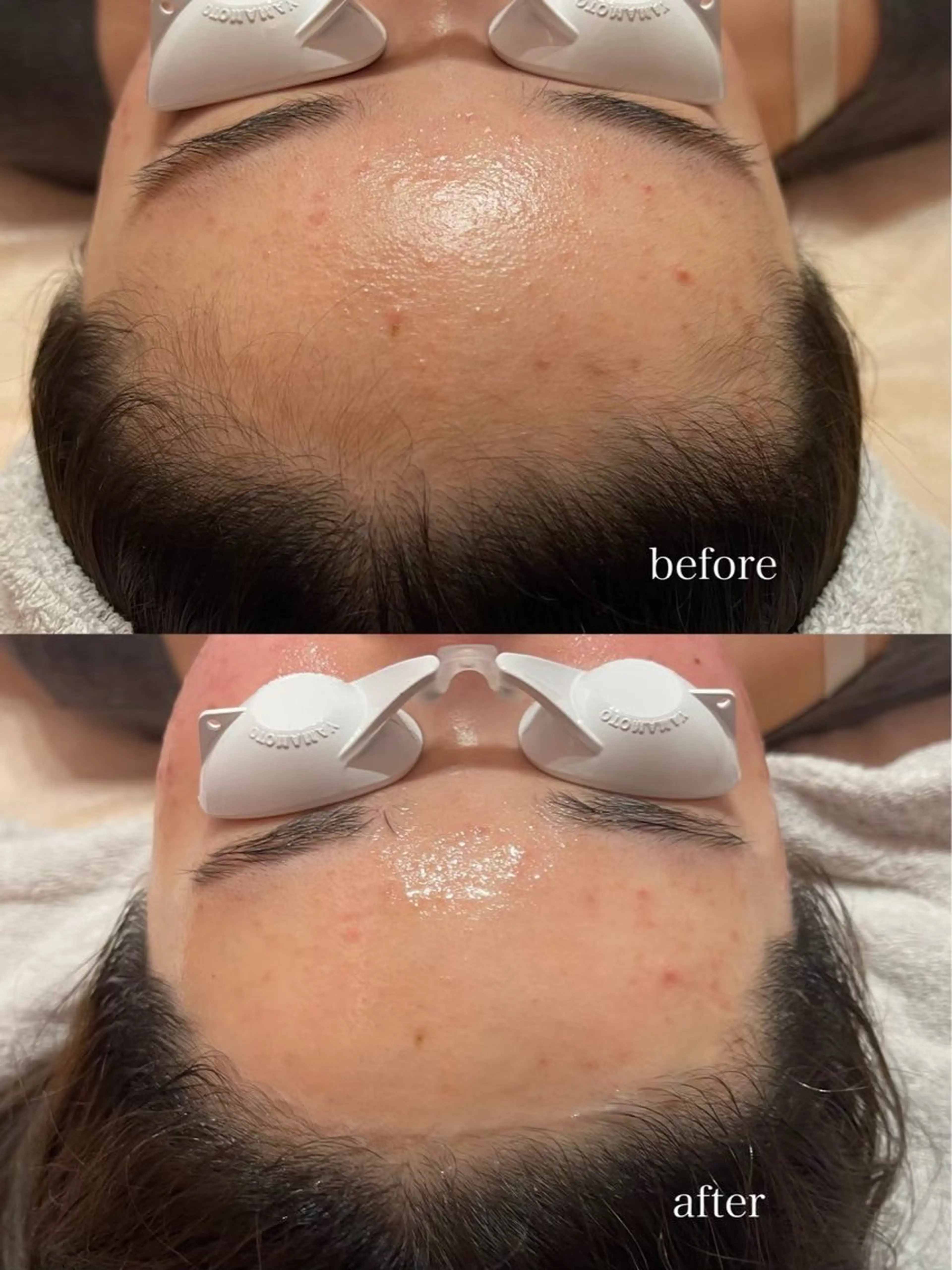 脱毛 SAERA yuyuのエステ・リラクイメージ