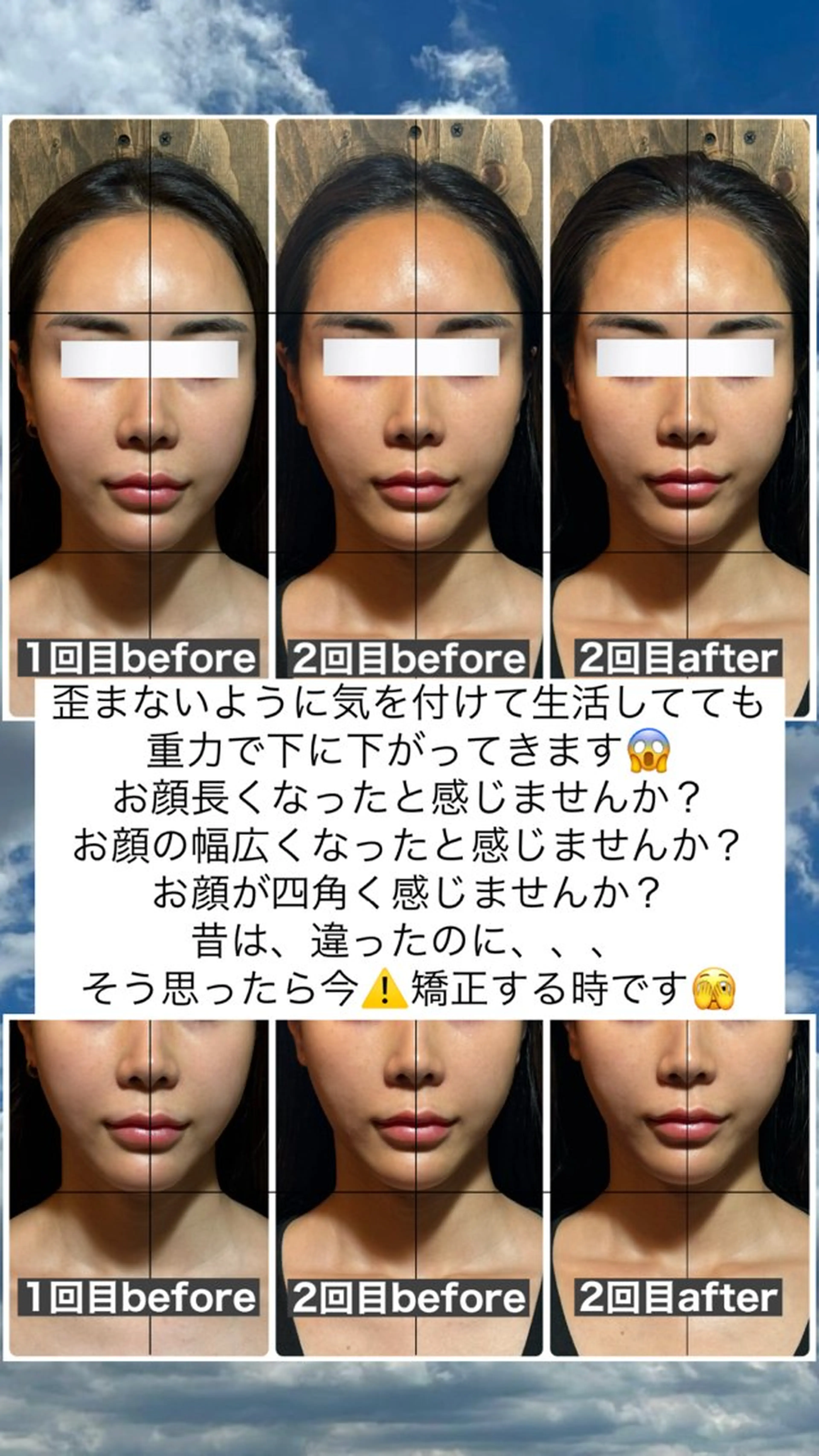 エステ リラク 💎後悔させない小顔 矯正💎イトヤマ🌱のエステ・リラクイメージ