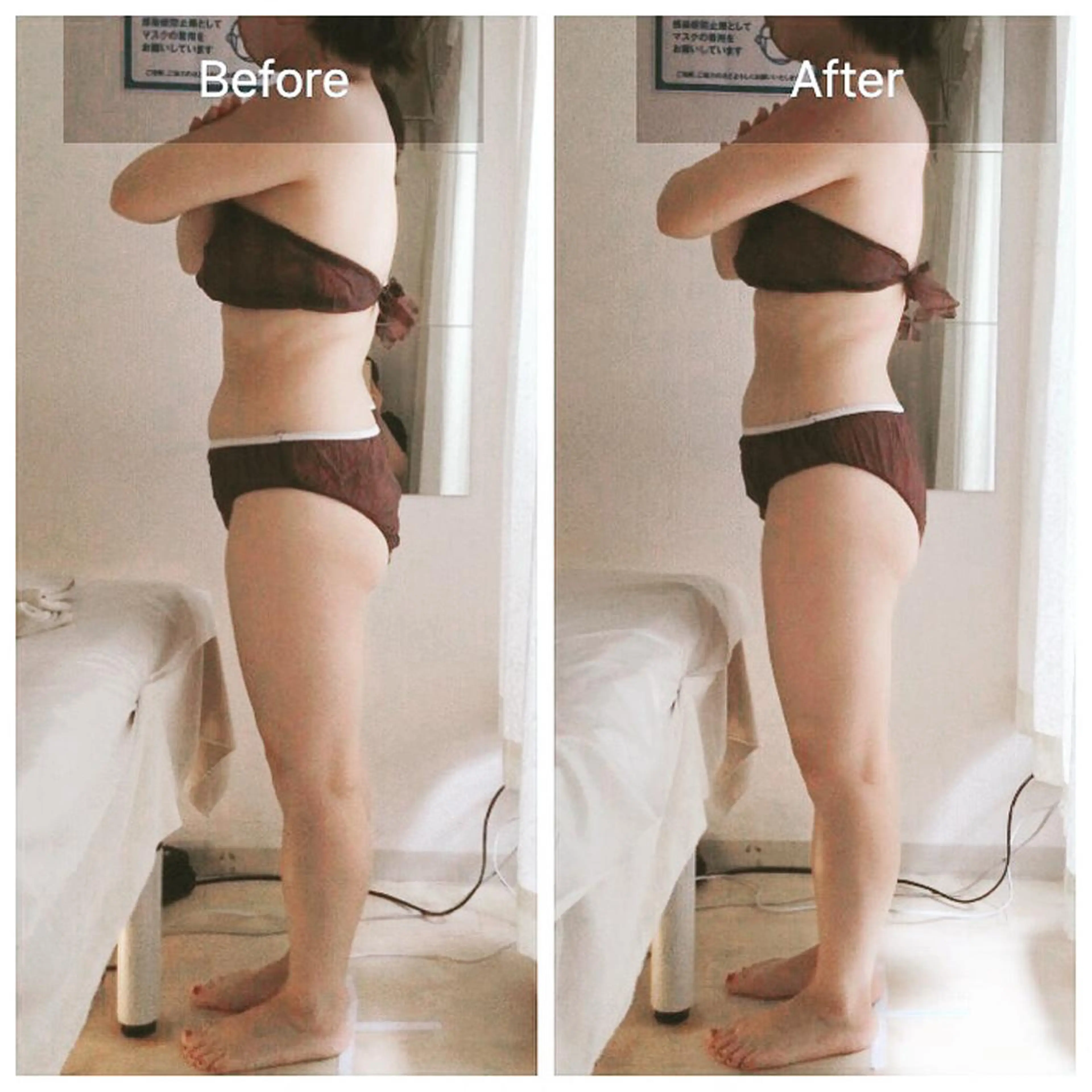 （KIE） 月額エステPRERYのエステ・リラクイメージ