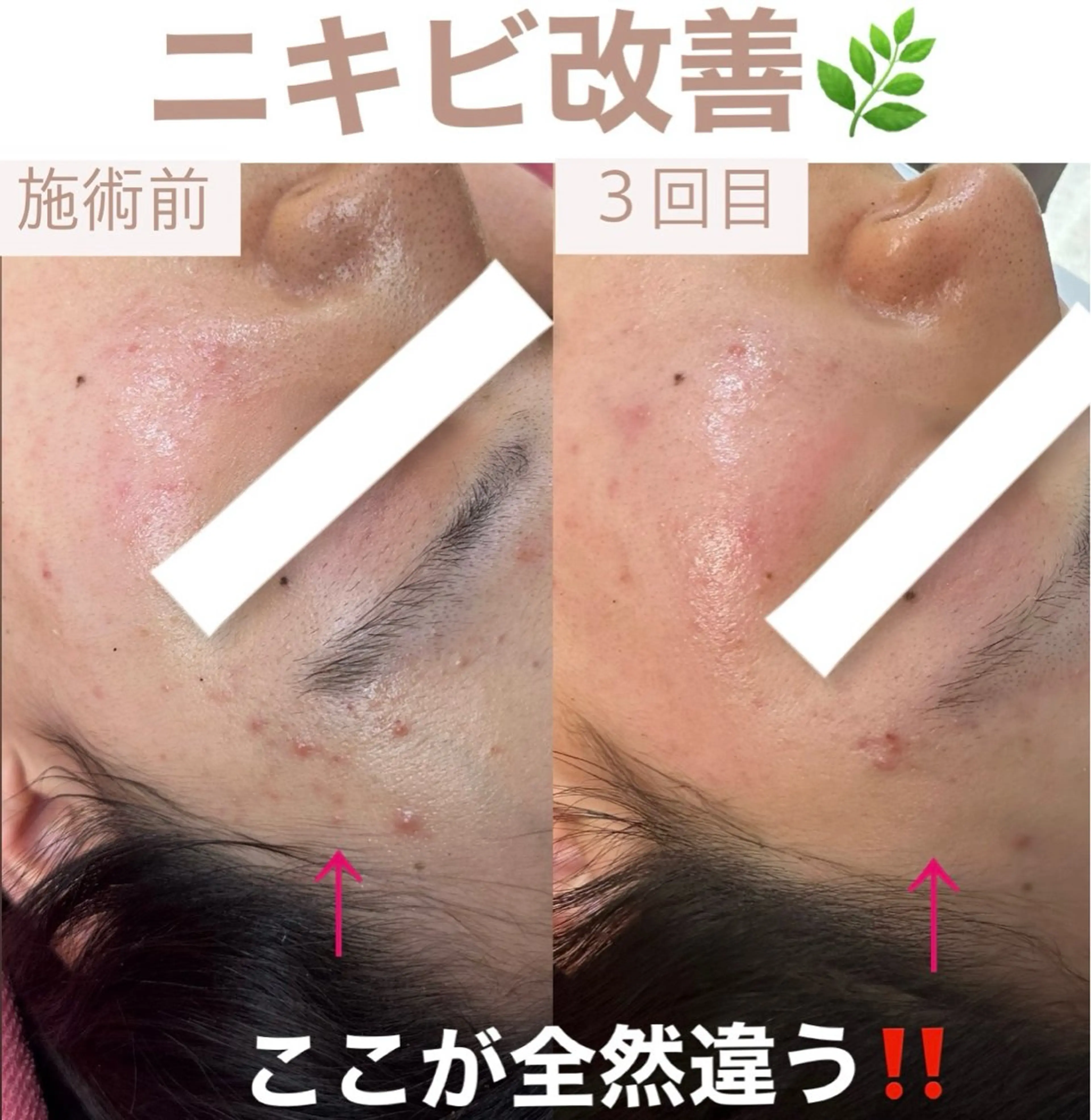 脱毛&美容サロン BLUESEAのエステ・リラクイメージ