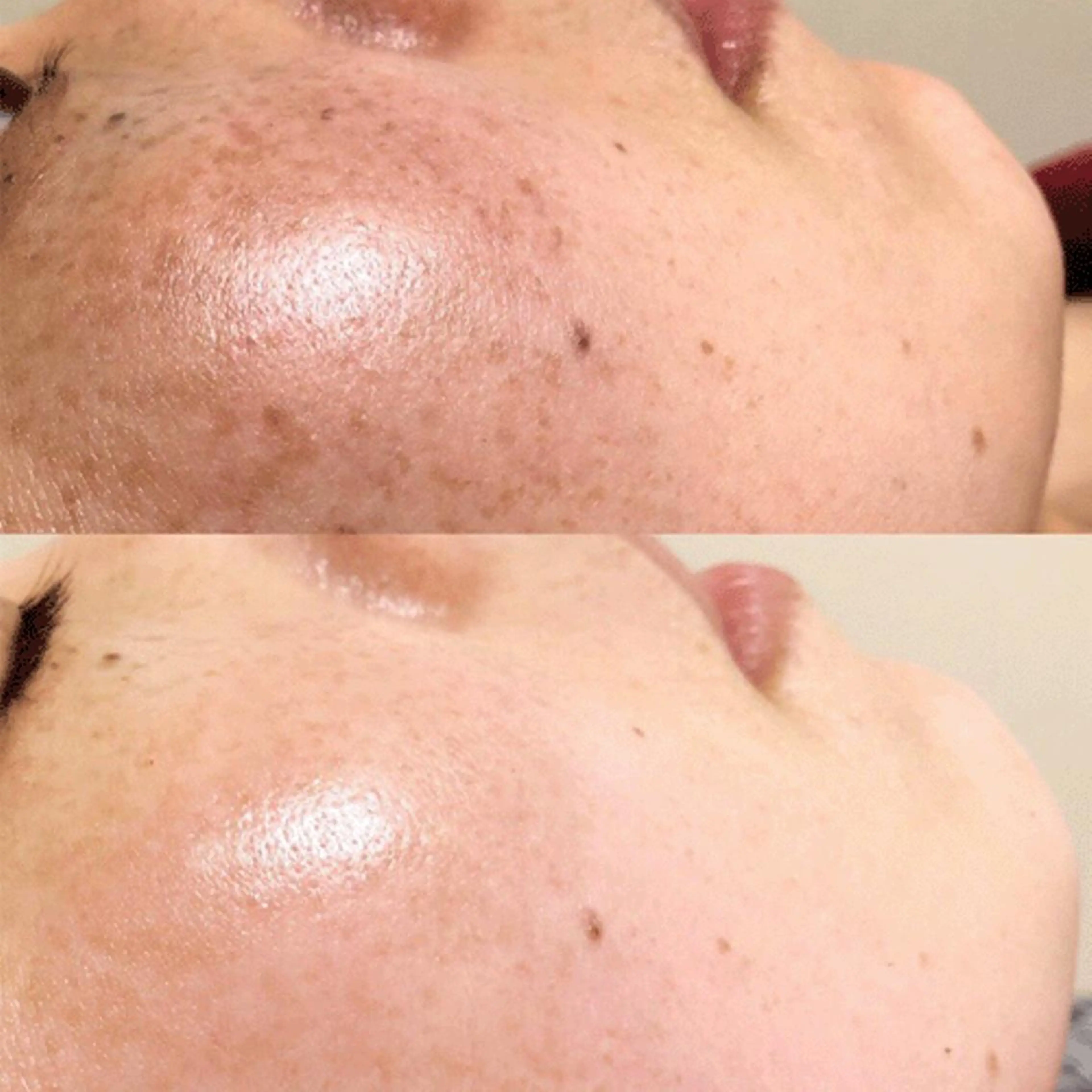 「シミ・くすみ撃退！発光美肌フォト✨」透明感がほしい🔸シミ・くすみが気になる毛穴レスなツヤ肌になりたいそんなあなたにの写真