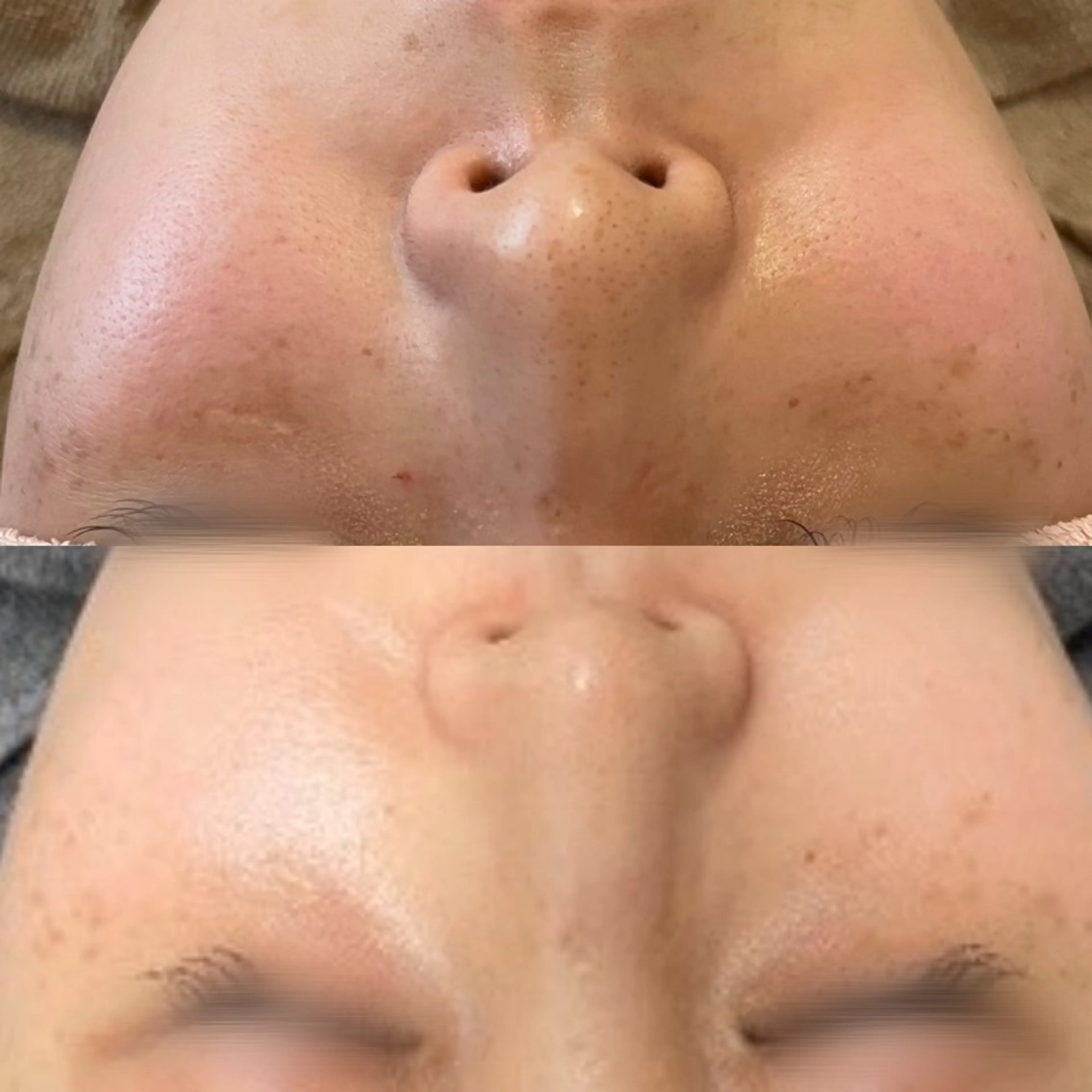 エステ シミケア専門サロンL ino所属・シミケア専門サロン Linoのエステ・リラクイメージ