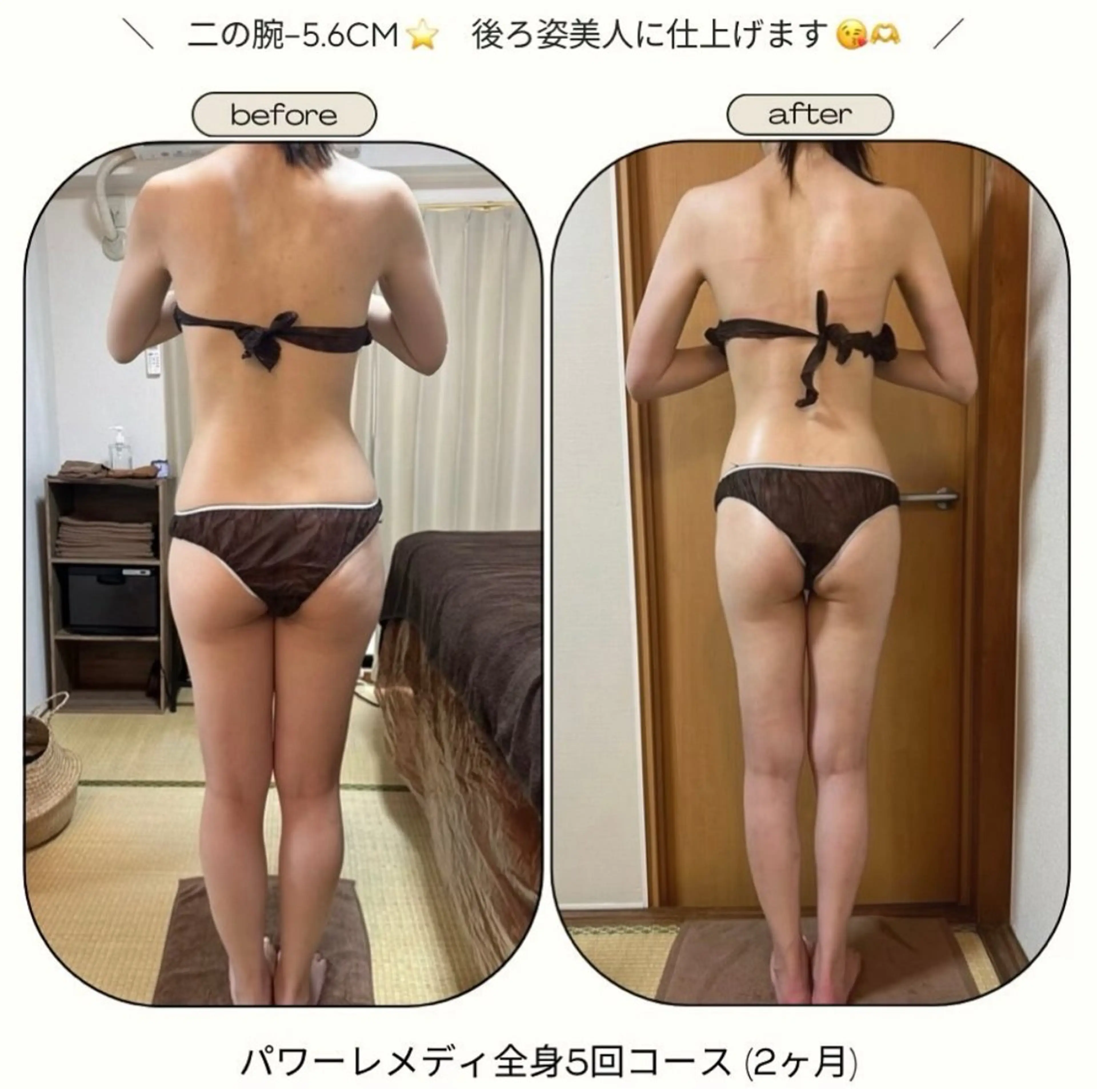 《本気痩せ×疲労改善 》  BILOOPのエステ・リラクイメージ