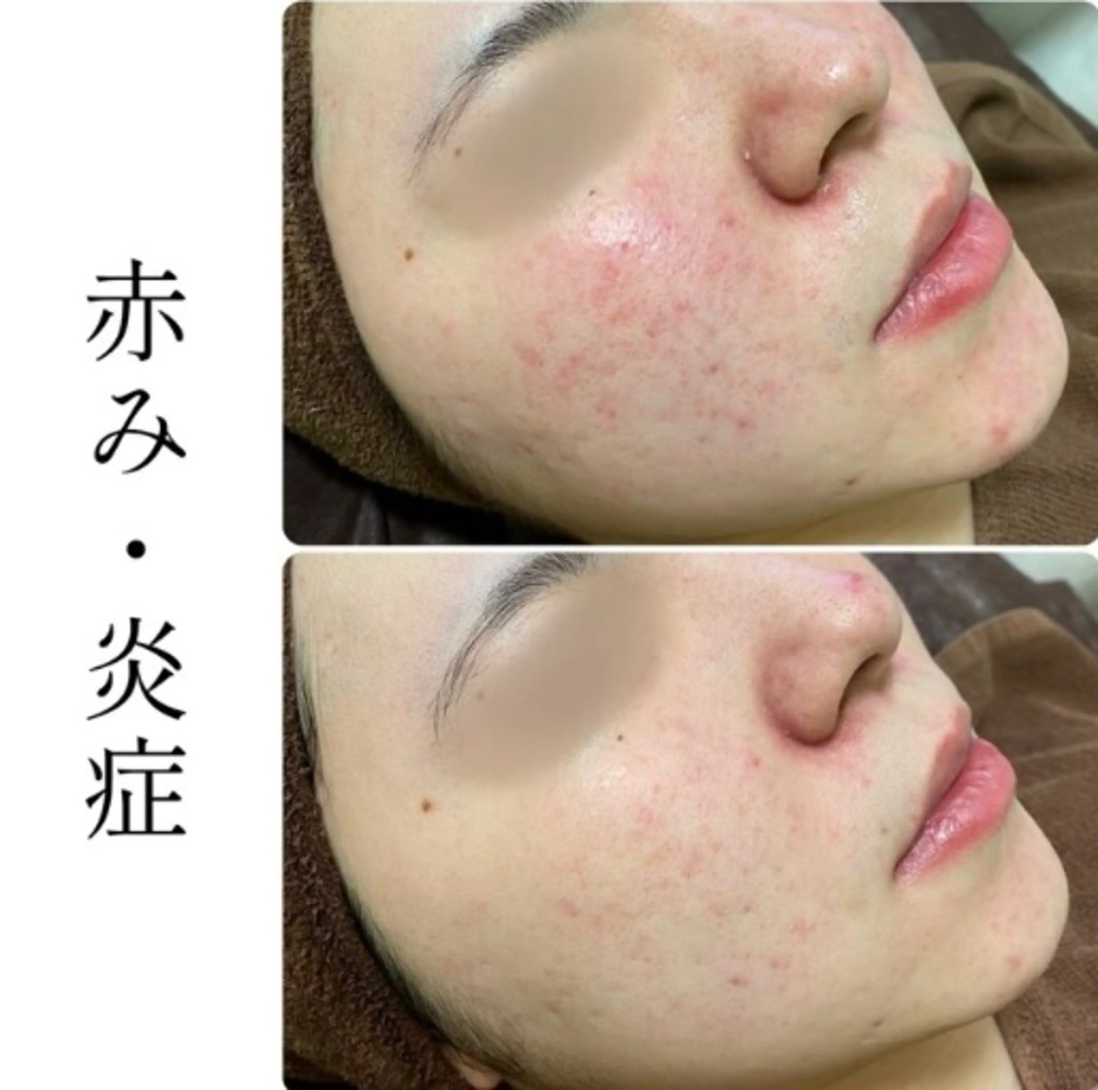 エステ ハーブピーリング専門 BIOPLUS+川崎のエステ・リラクイメージ