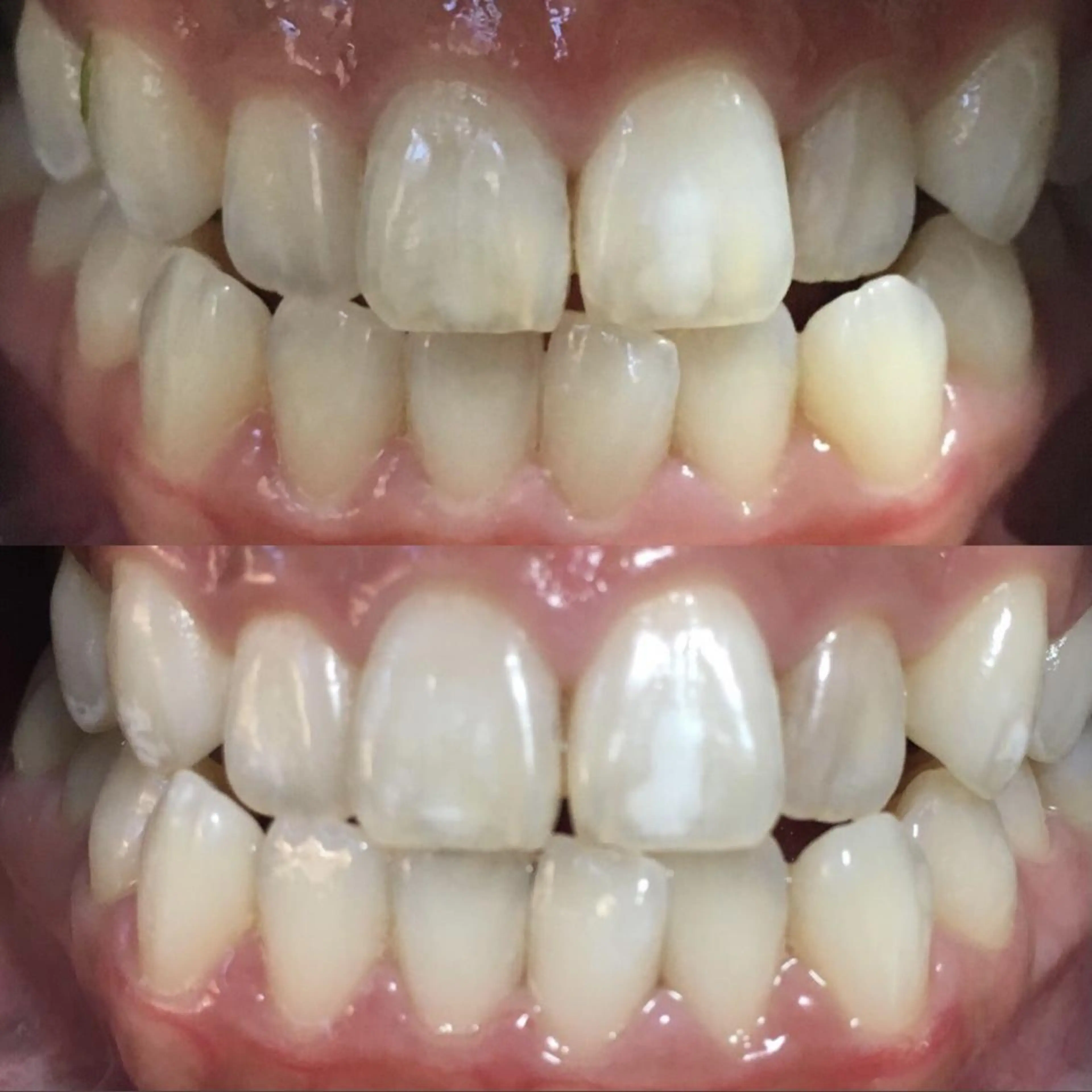 LBSホワイトニング 新宿店💎店長のエステ・リラクイメージ