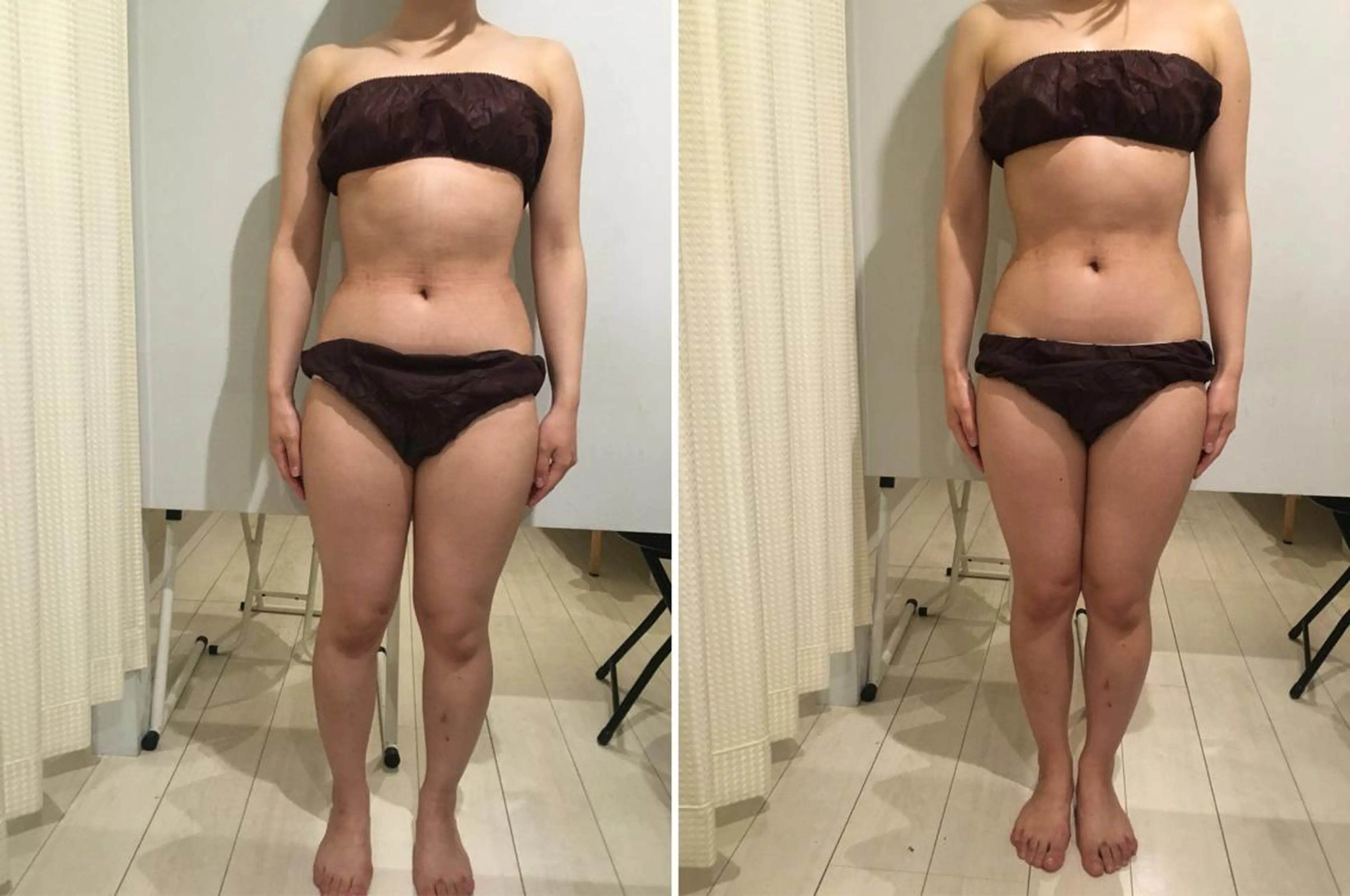 アニメ,Vオタク× 即効痩せエステサロンのエステ・リラクイメージ