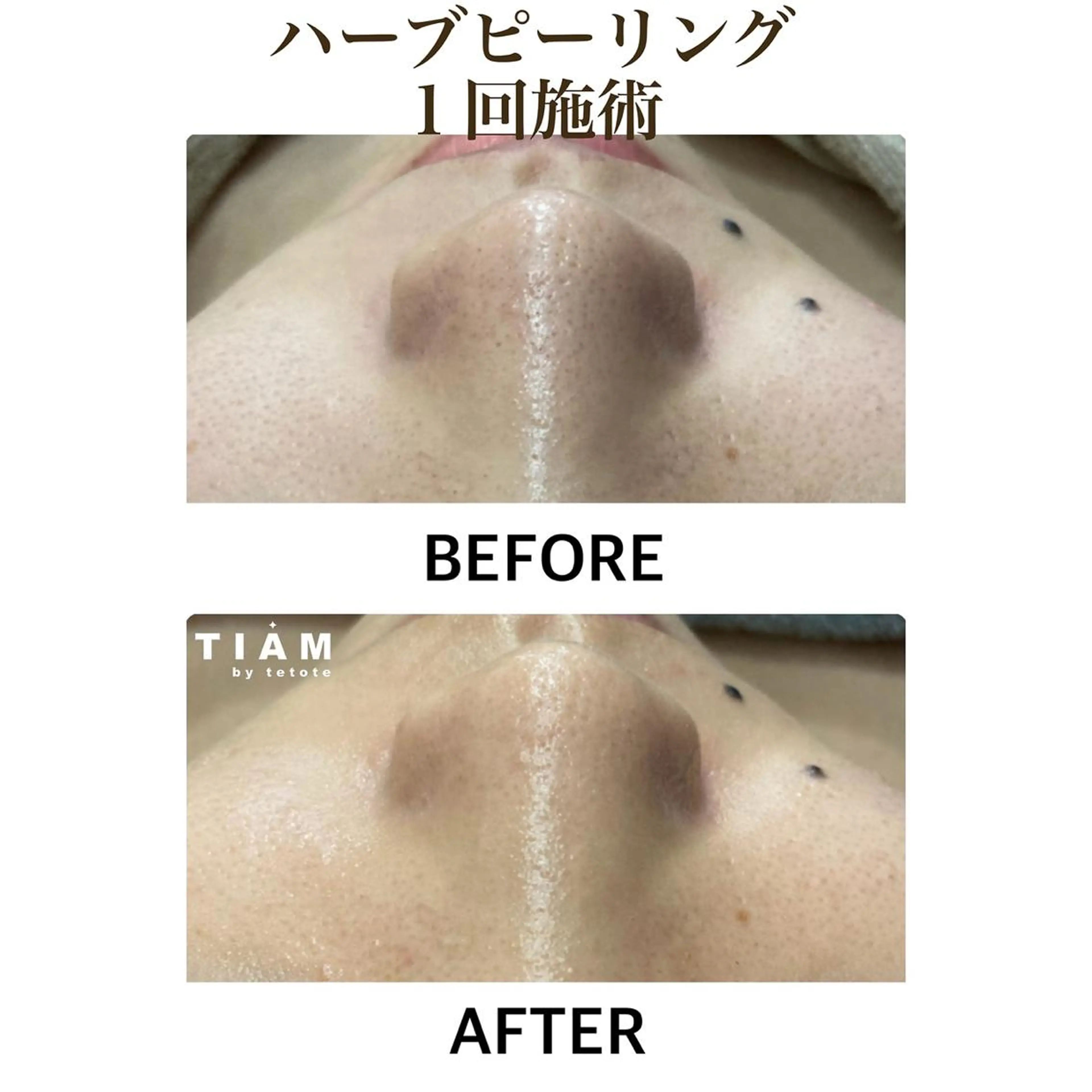 エステ 美肌サロンTIAM by tetoteのエステ・リラクイメージ