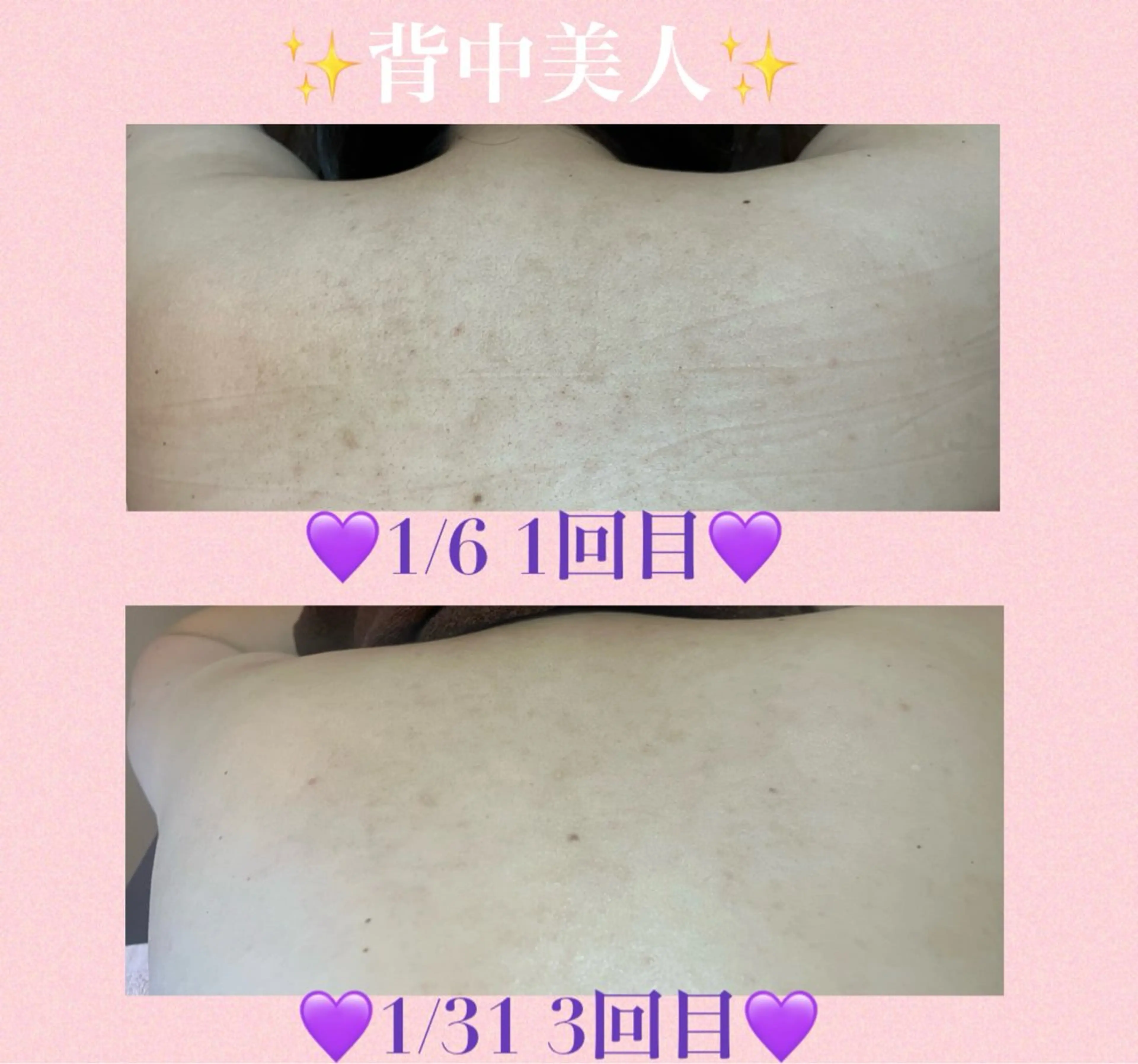 3/25迄ハーブ ピーリングBloomのエステ・リラクイメージ