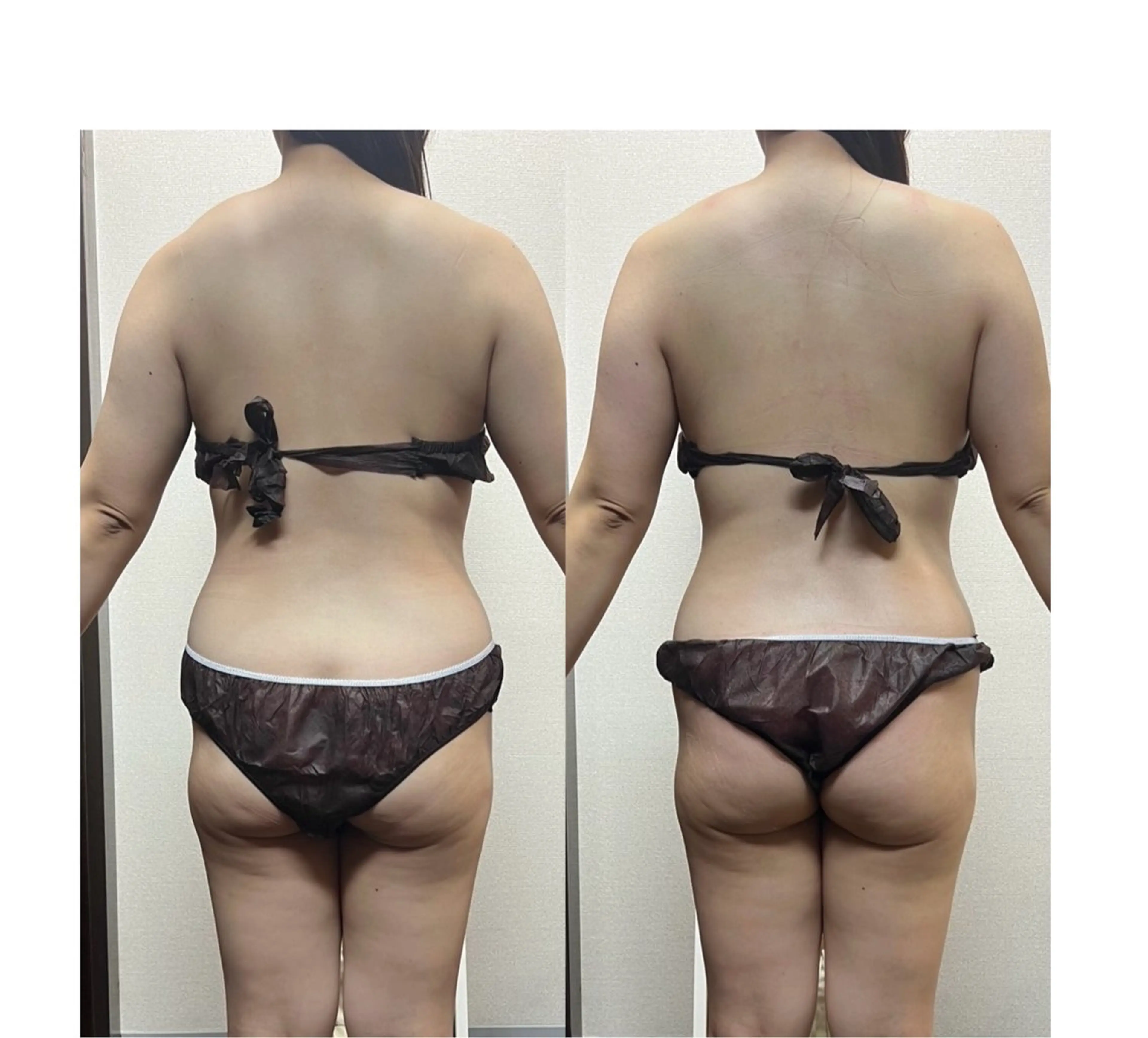 ハイパーナイフ専門店　Salon de COCO所属・Salon de COCOのエステ・リラクイメージ