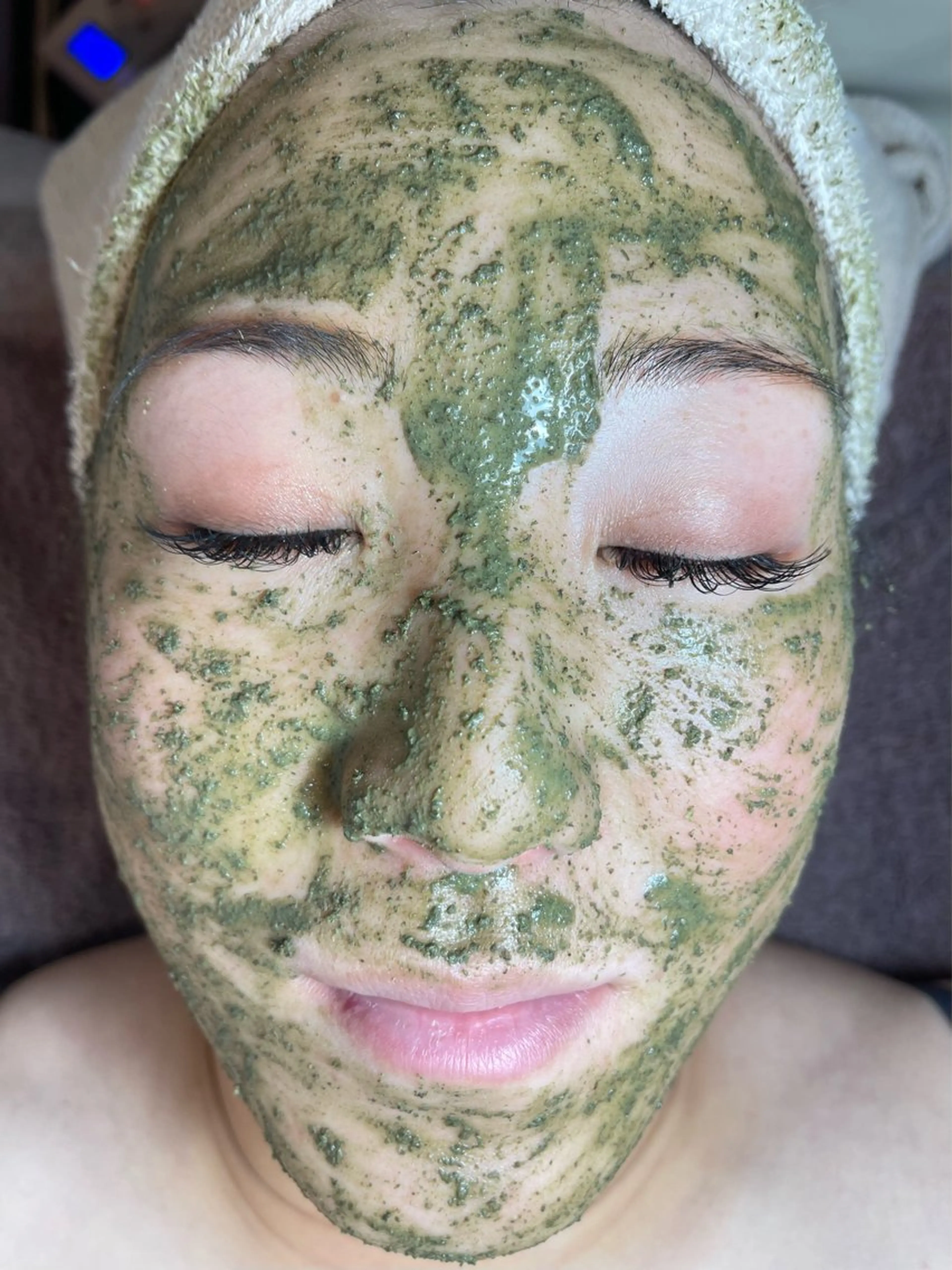 REVI 陶器肌トリートメントの写真