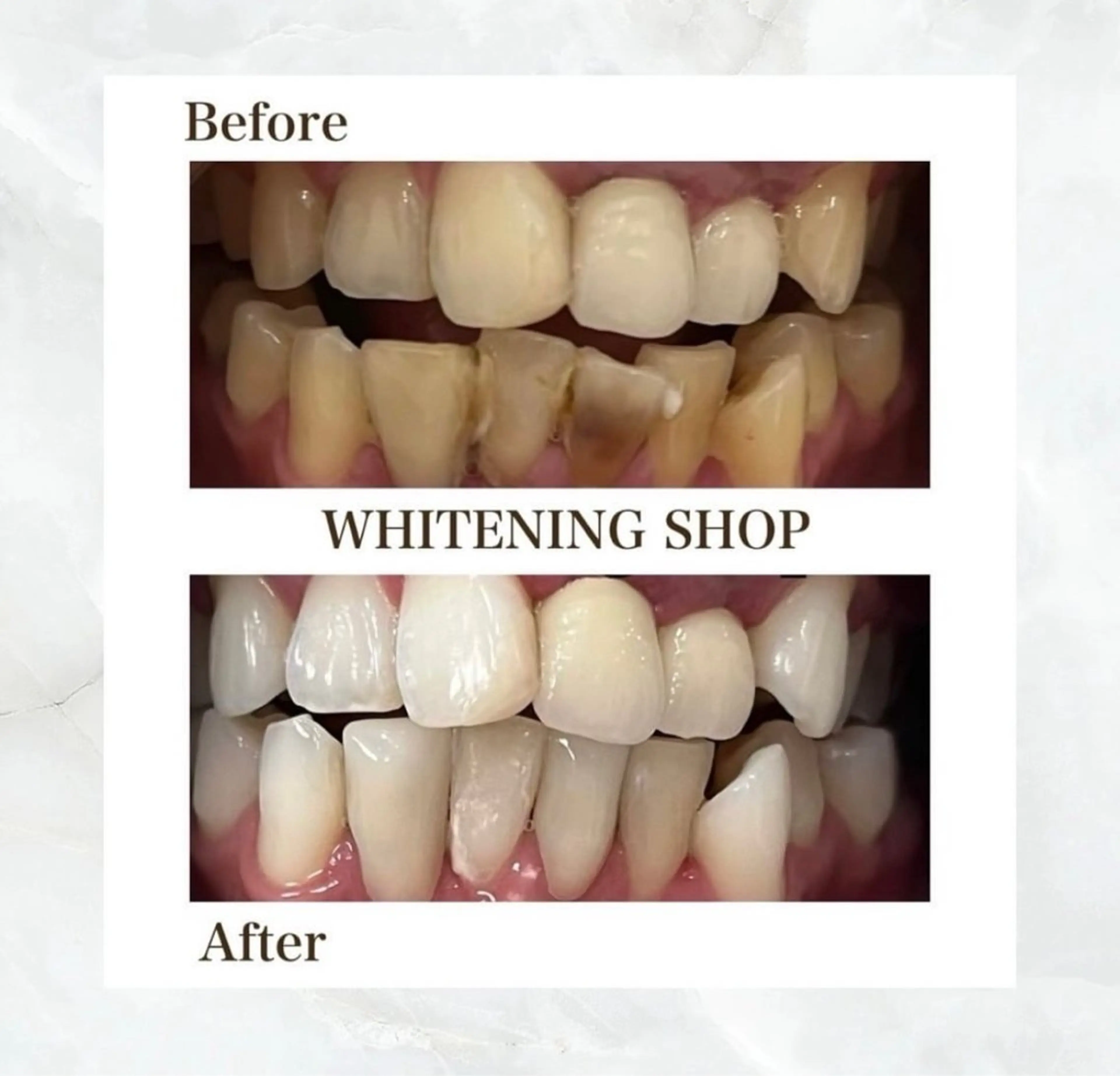 ホワイトニング ショップ伊丹店のその他イメージ