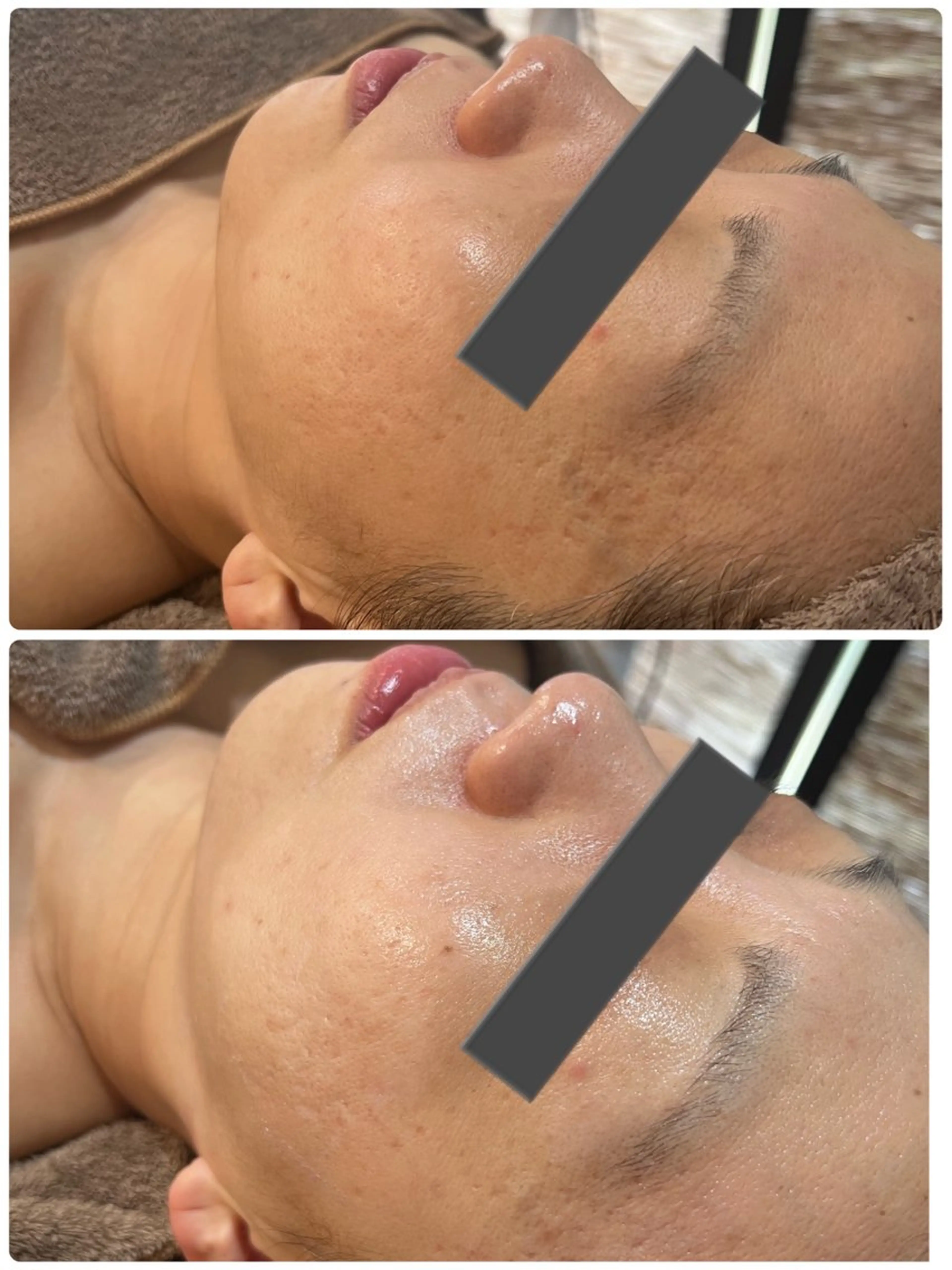 ハーブ/小顔/リンパ /大阪狭山市のエステ・リラクイメージ