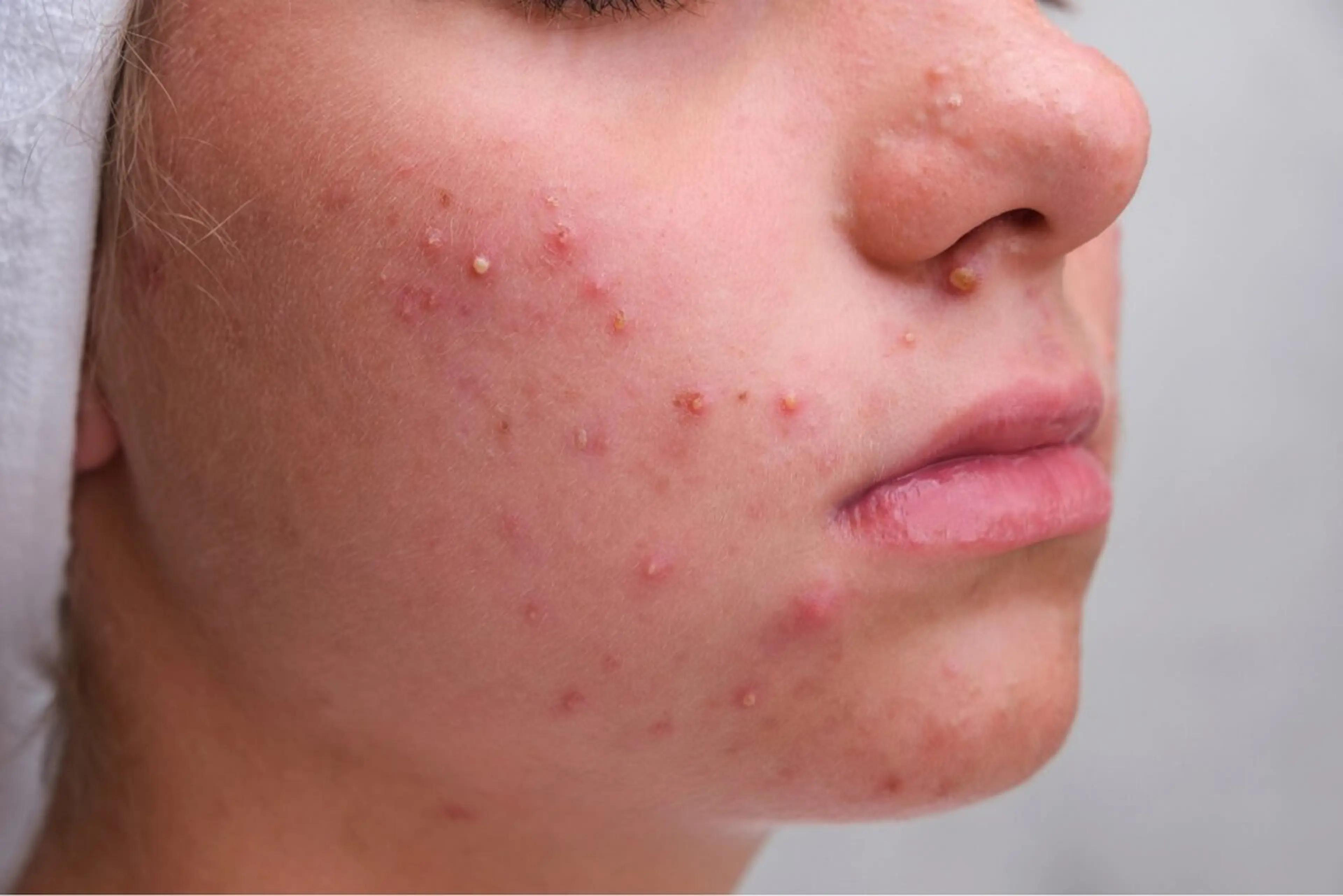 エステ リラク 毛穴・美肌専門 〜ﾛｰｽﾞﾄﾞﾒ〜のエステ・リラクイメージ