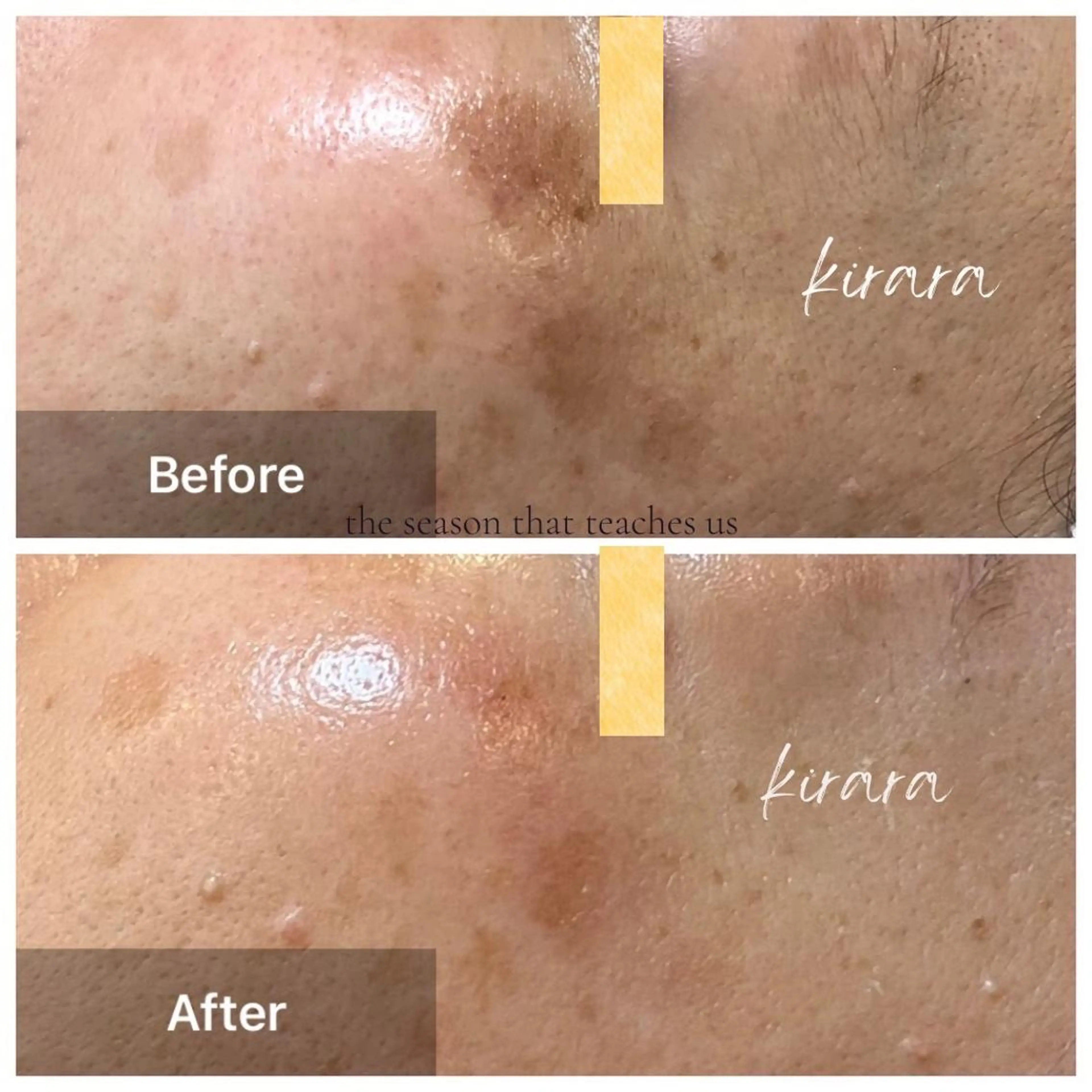 エステサロンきらら 瀧澤のエステ・リラクイメージ