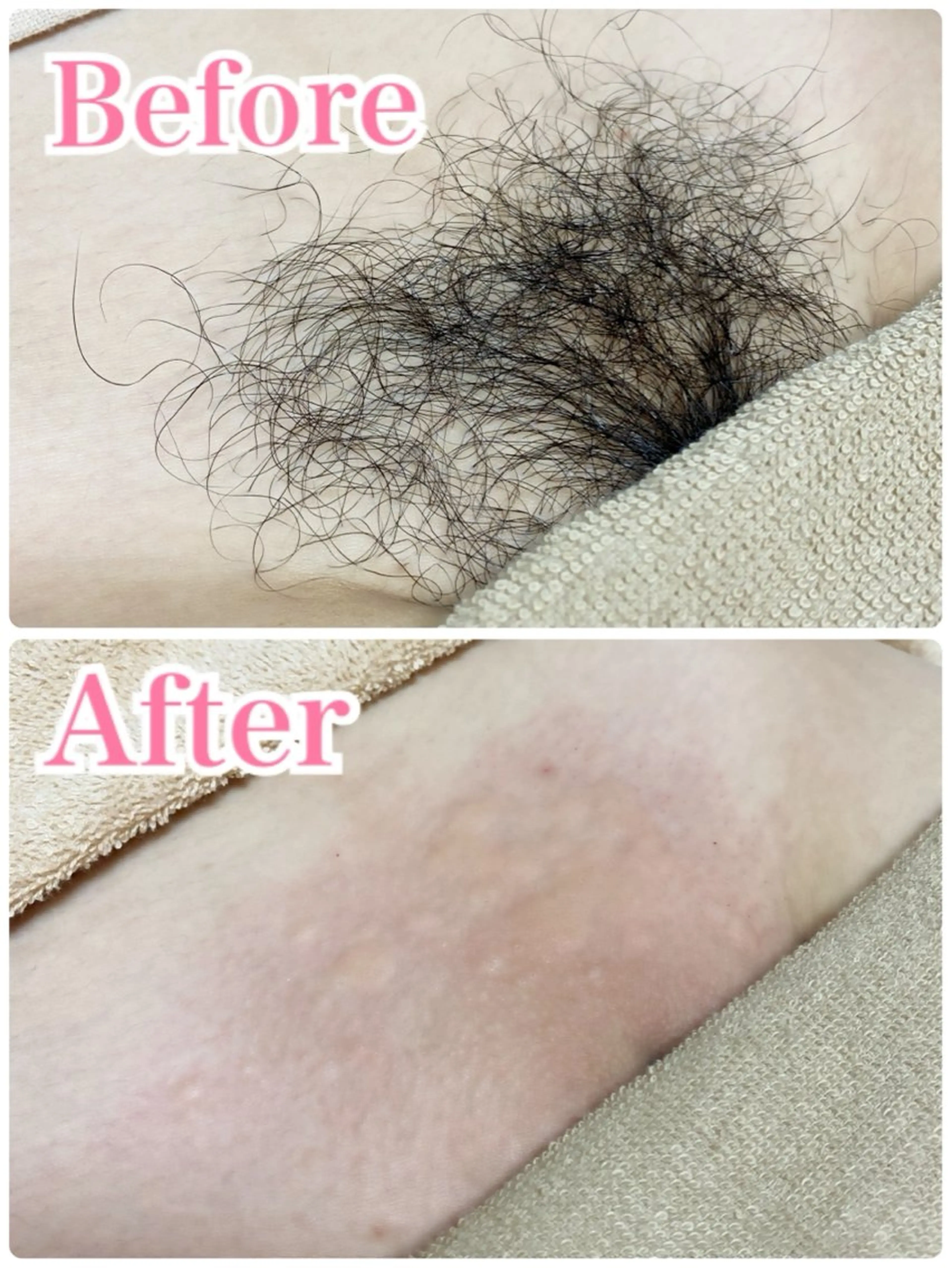 マツエク・マツパ シュガーリング脱毛 専門店Ranunのエステ・リラクイメージ