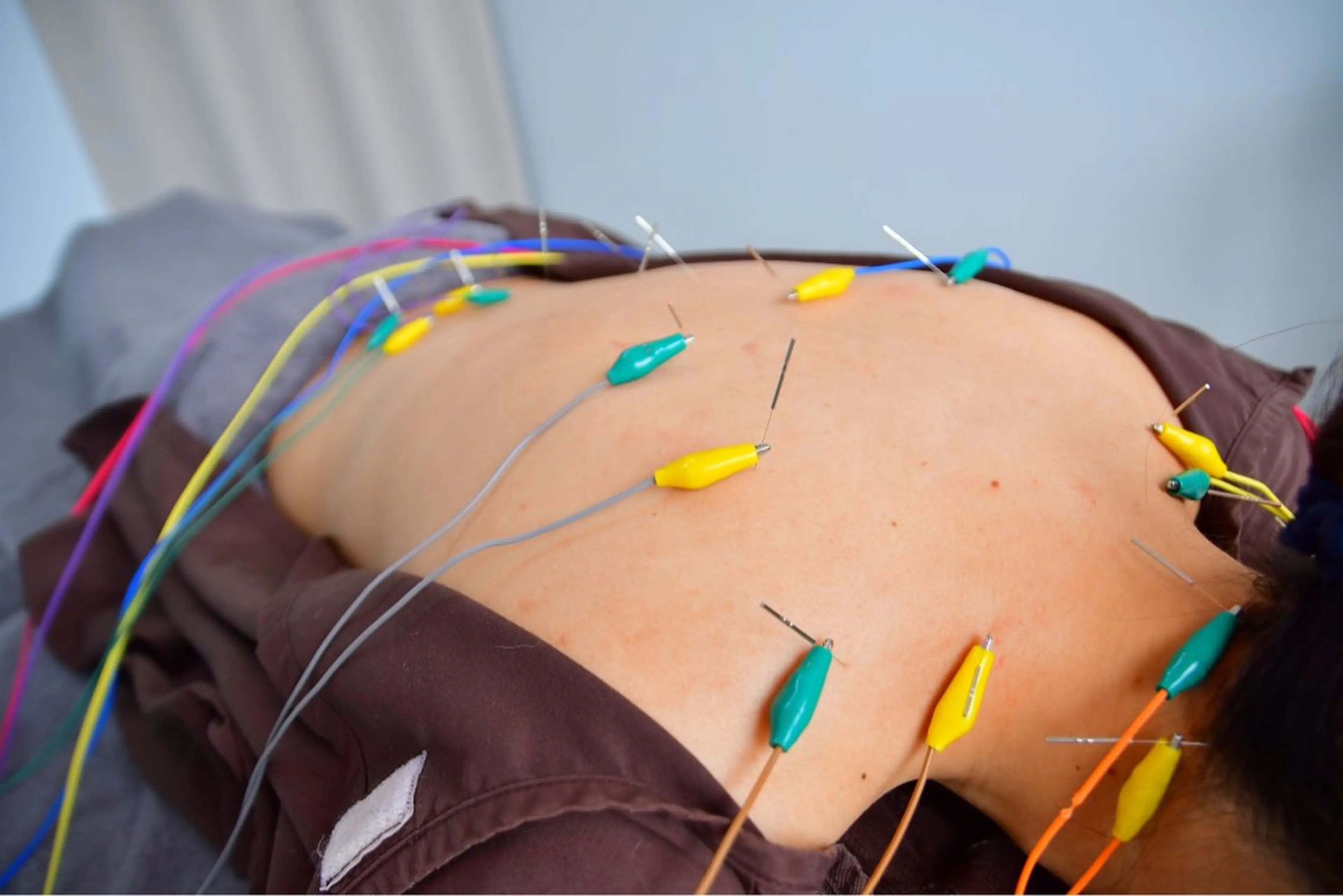 【初回鍼灸施術40分】肩こり・腰痛など気になる方に☆の写真