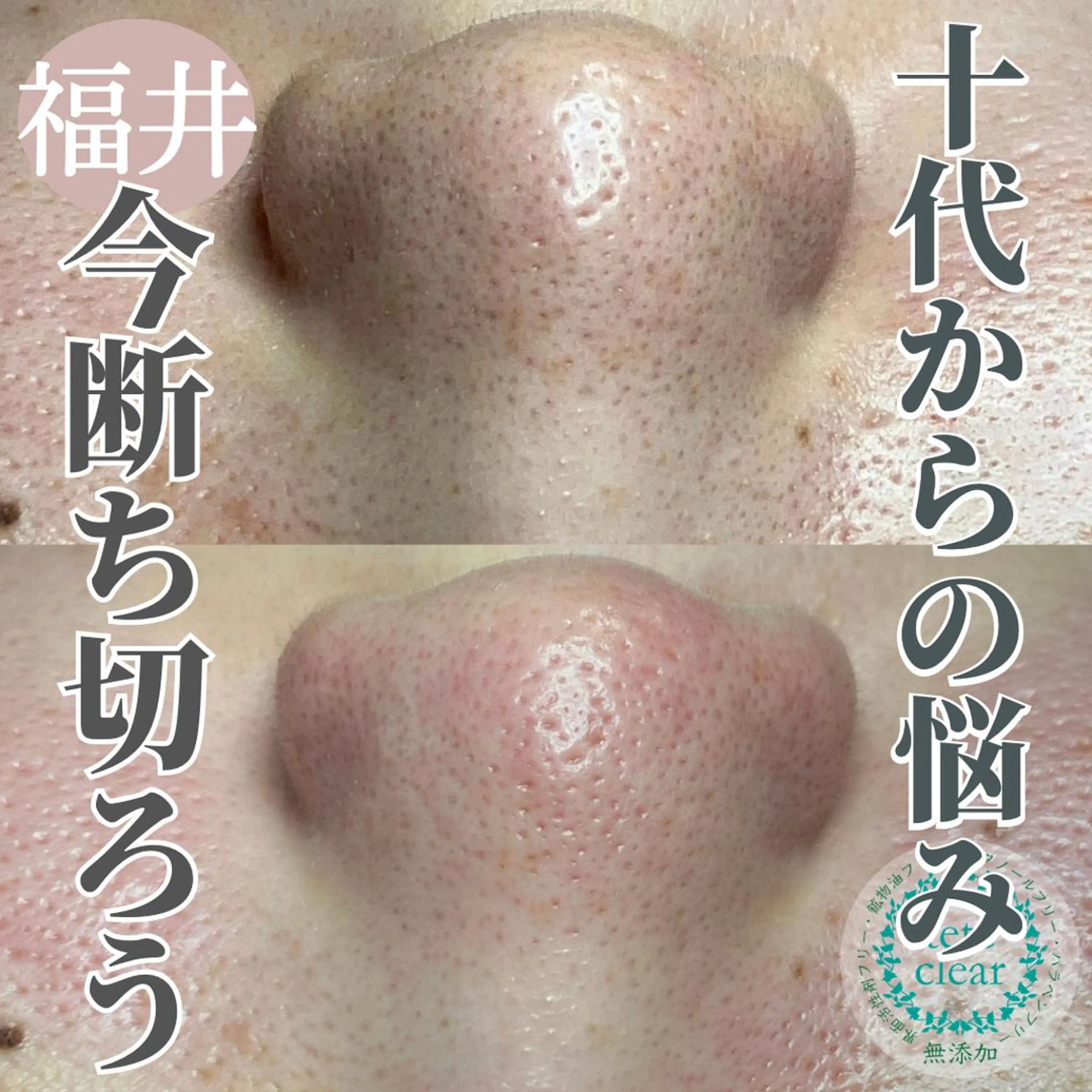 毛穴肌質ケアサロン Yourmeユアミーのエステ・リラクイメージ