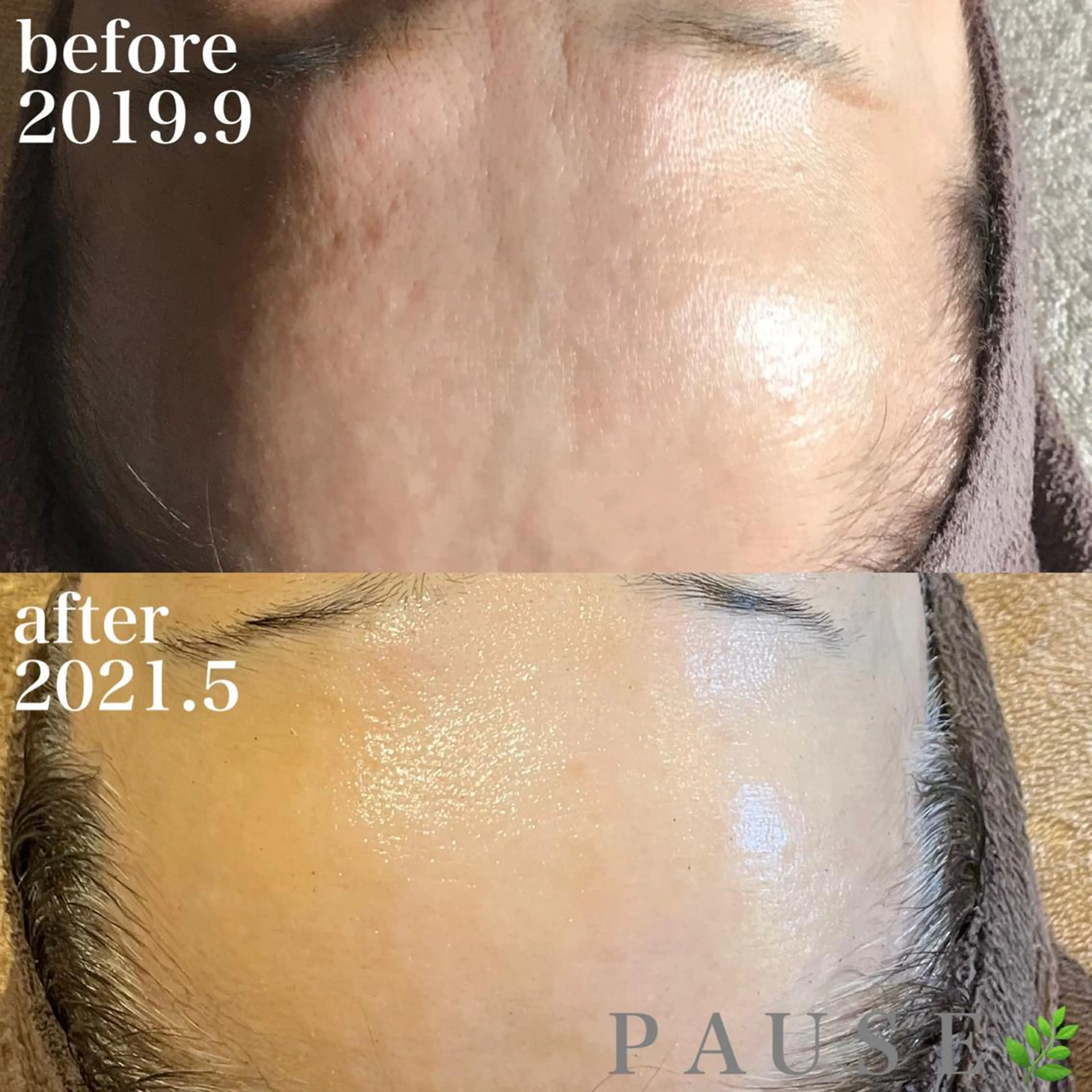 エステ 浜野 恵美のエステ・リラクイメージ