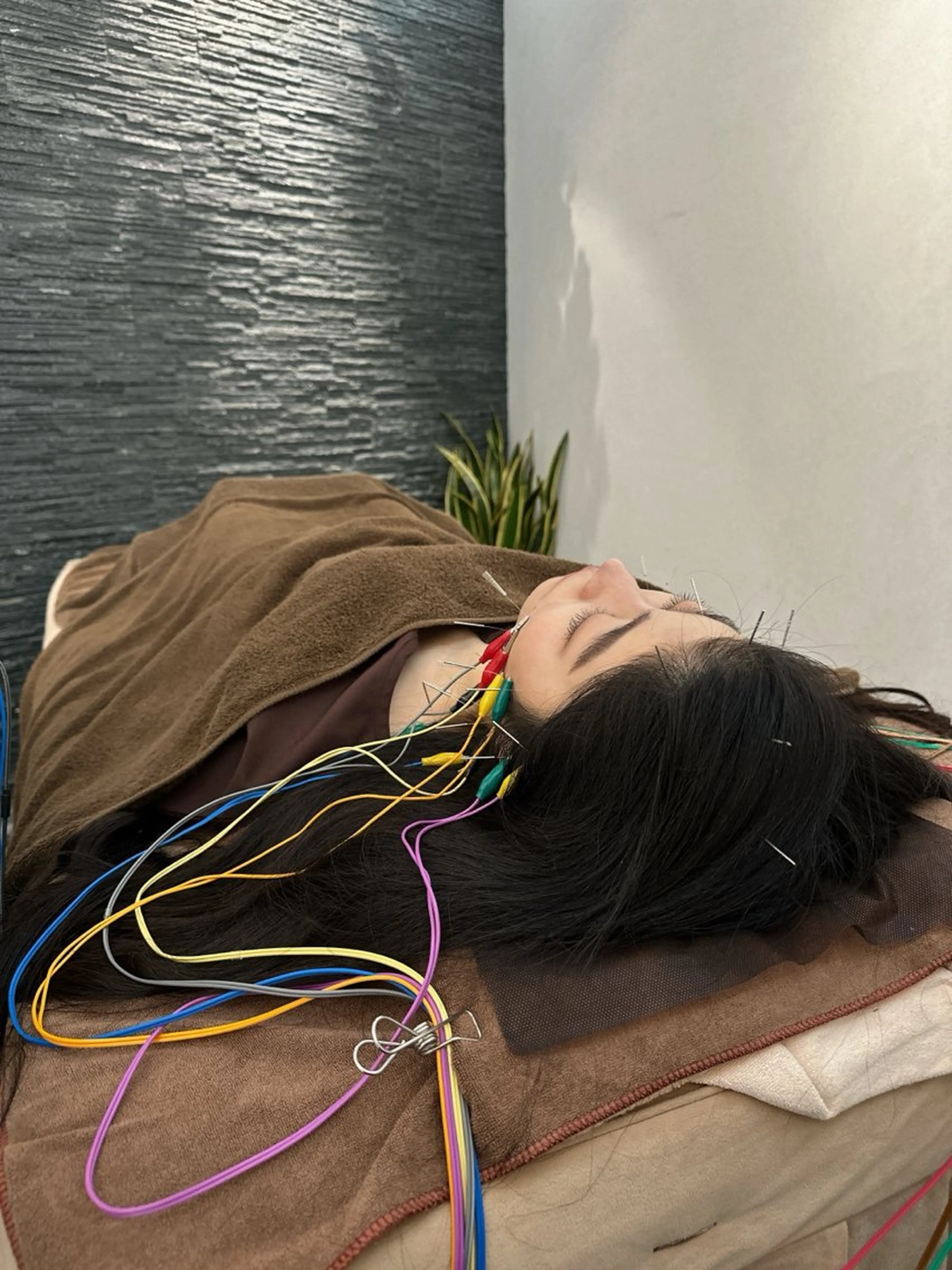 その他 小顔矯/美容鍼/鍼灸 BeauJuのその他イメージ