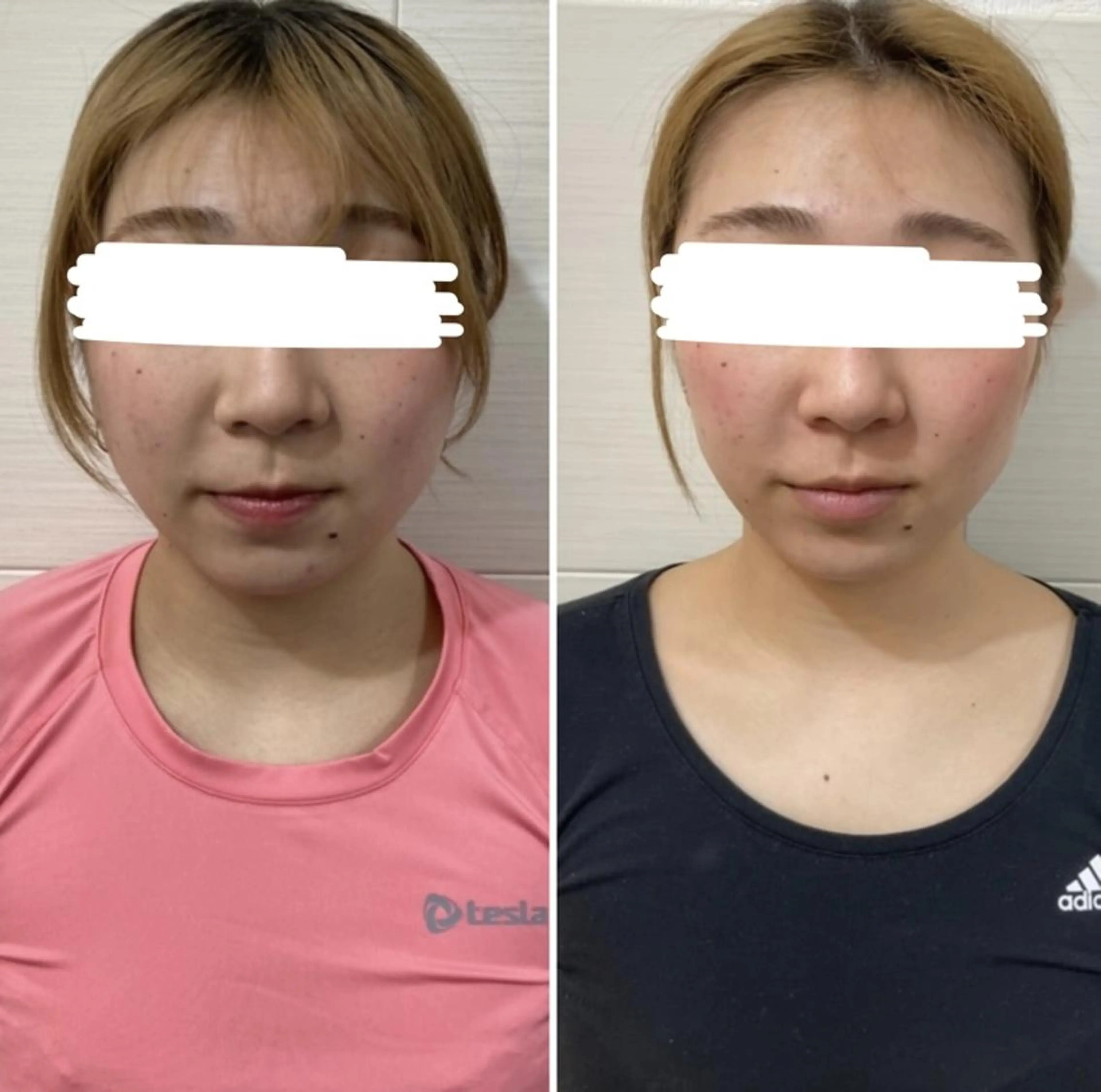 骨格美容整体 bimote.新宿のエステ・リラクイメージ