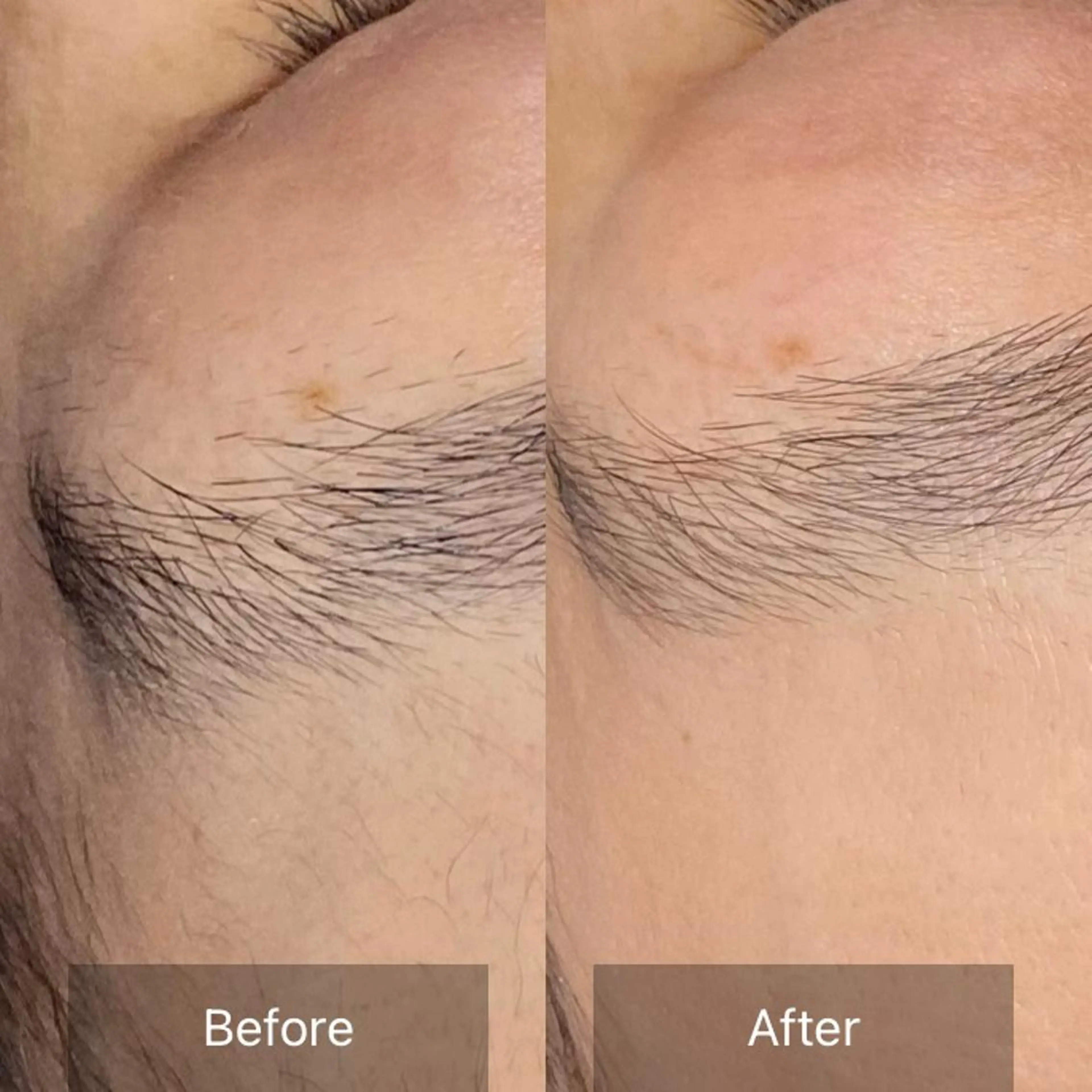 エステ 産毛専門店 Bittoのエステ・リラクイメージ