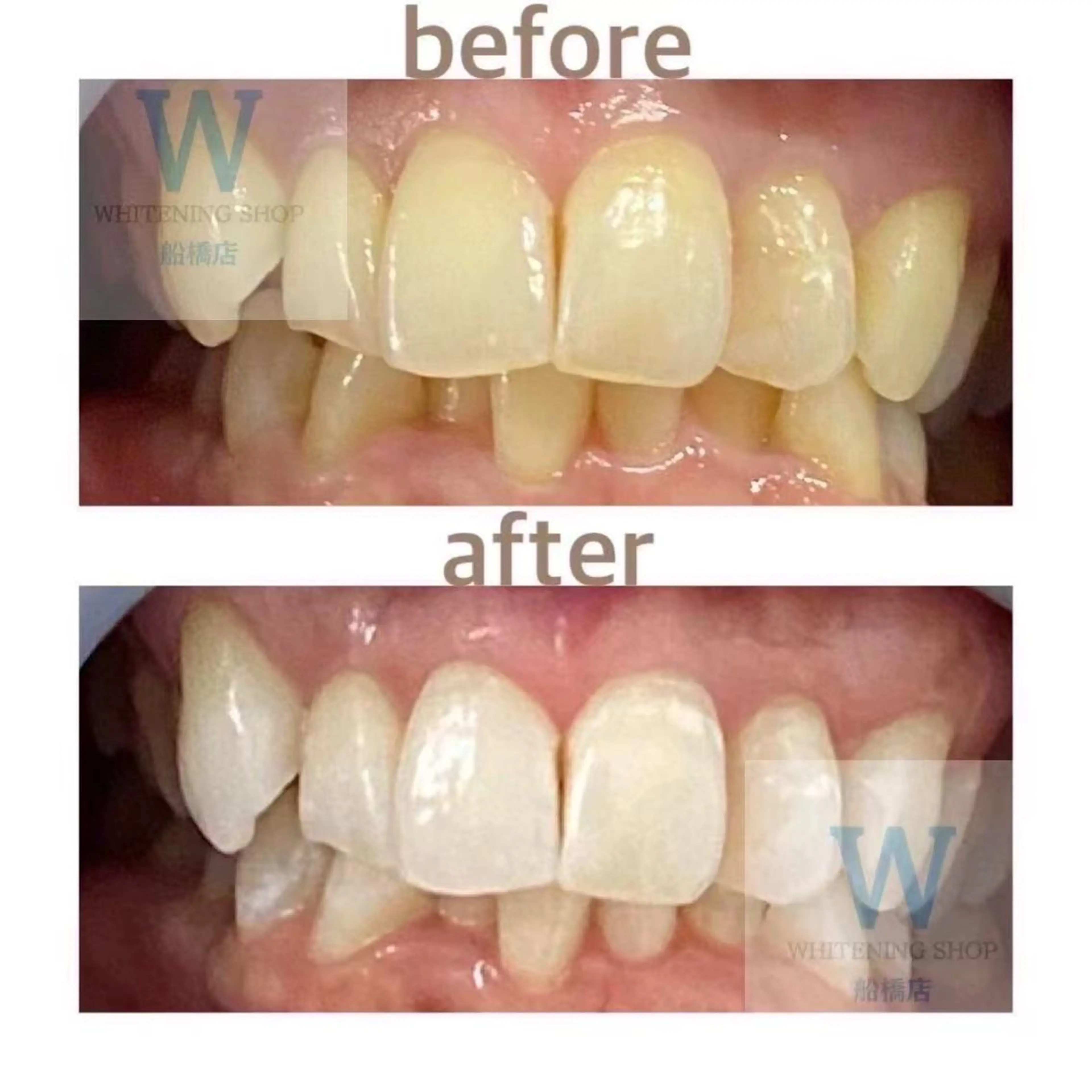 ホワイトニング ショップ船橋２号店のエステ・リラクイメージ