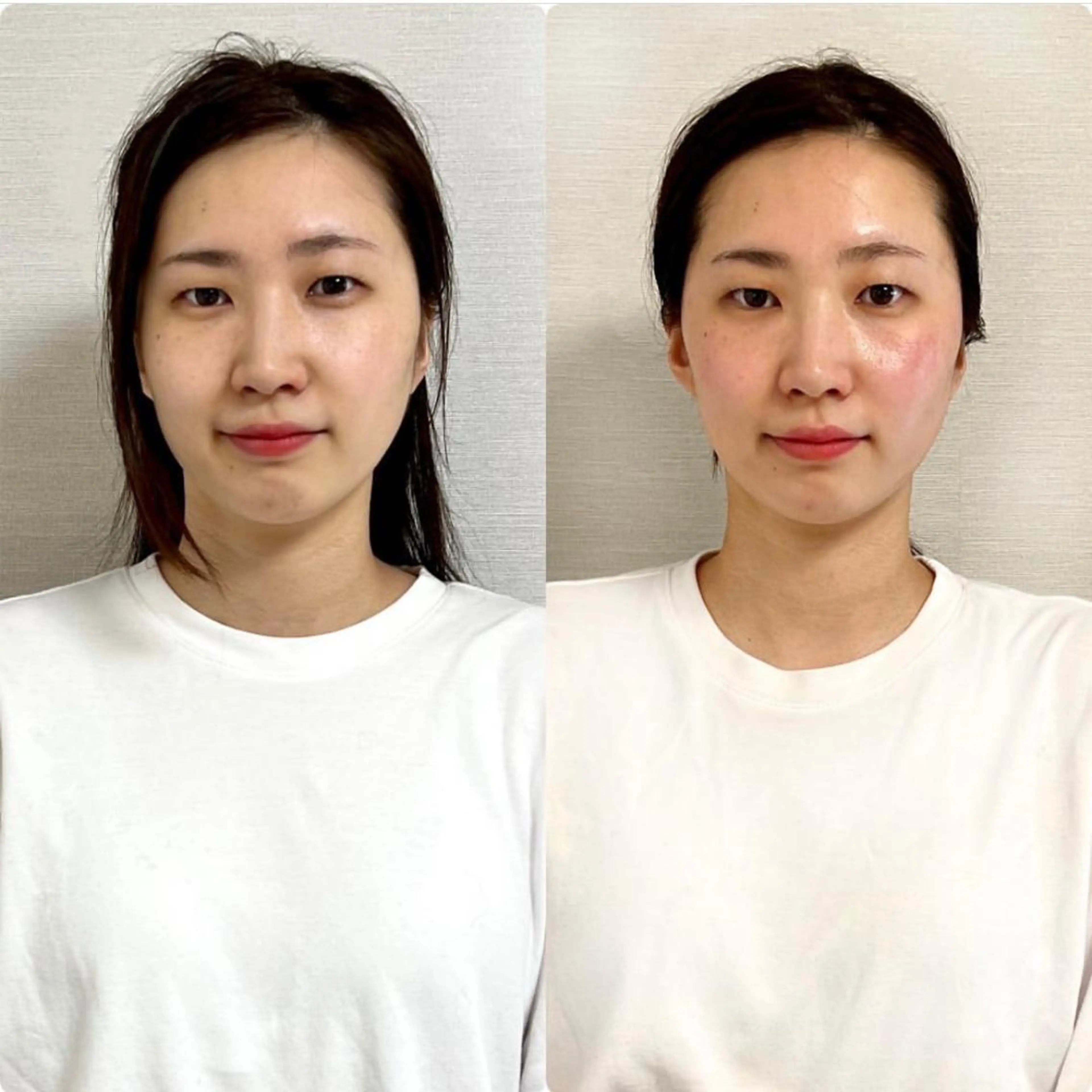 綺麗のひみつ グランプリ受賞店のエステ・リラクイメージ