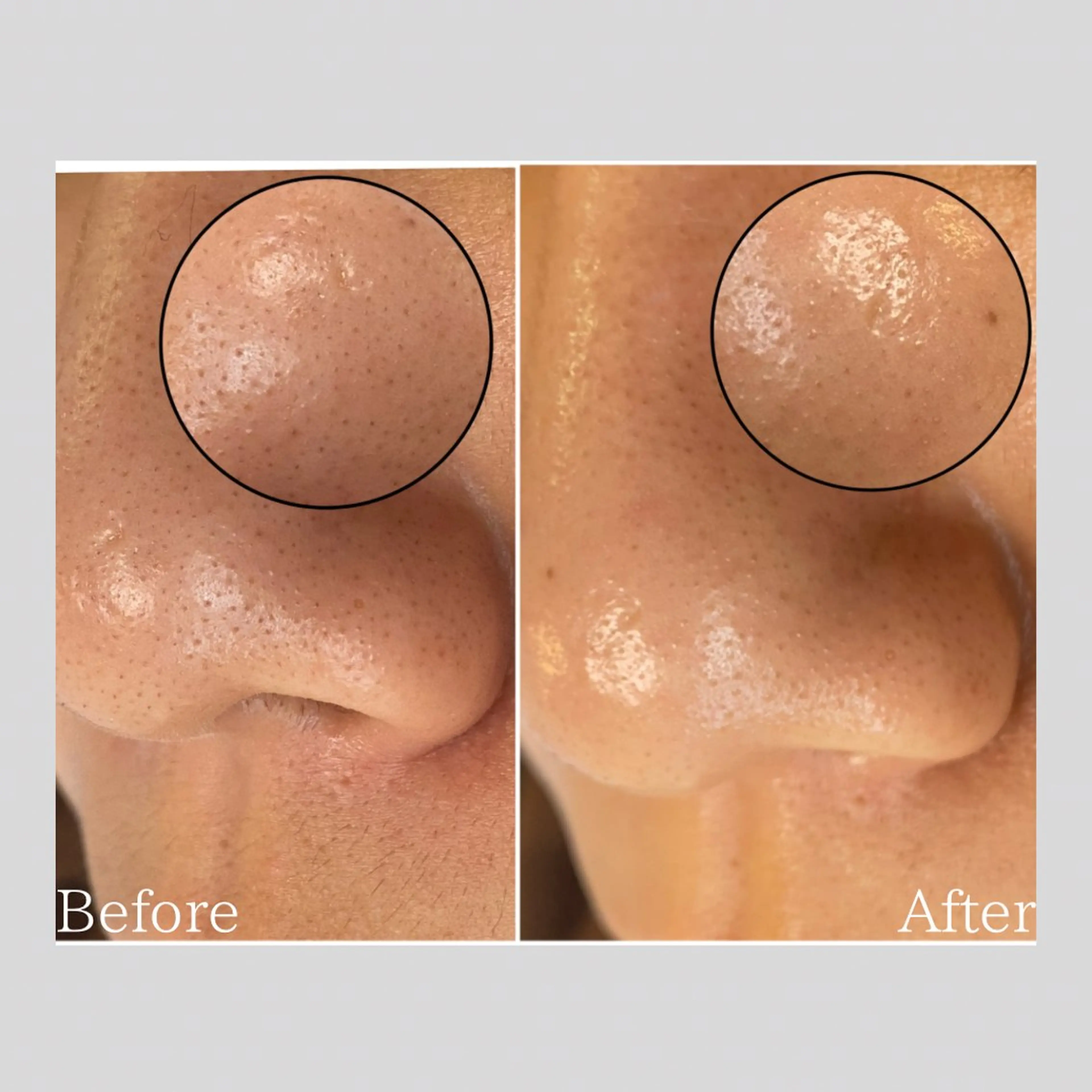 エステ リラク 韓国肌管理 【毛穴専科】のエステ・リラクイメージ