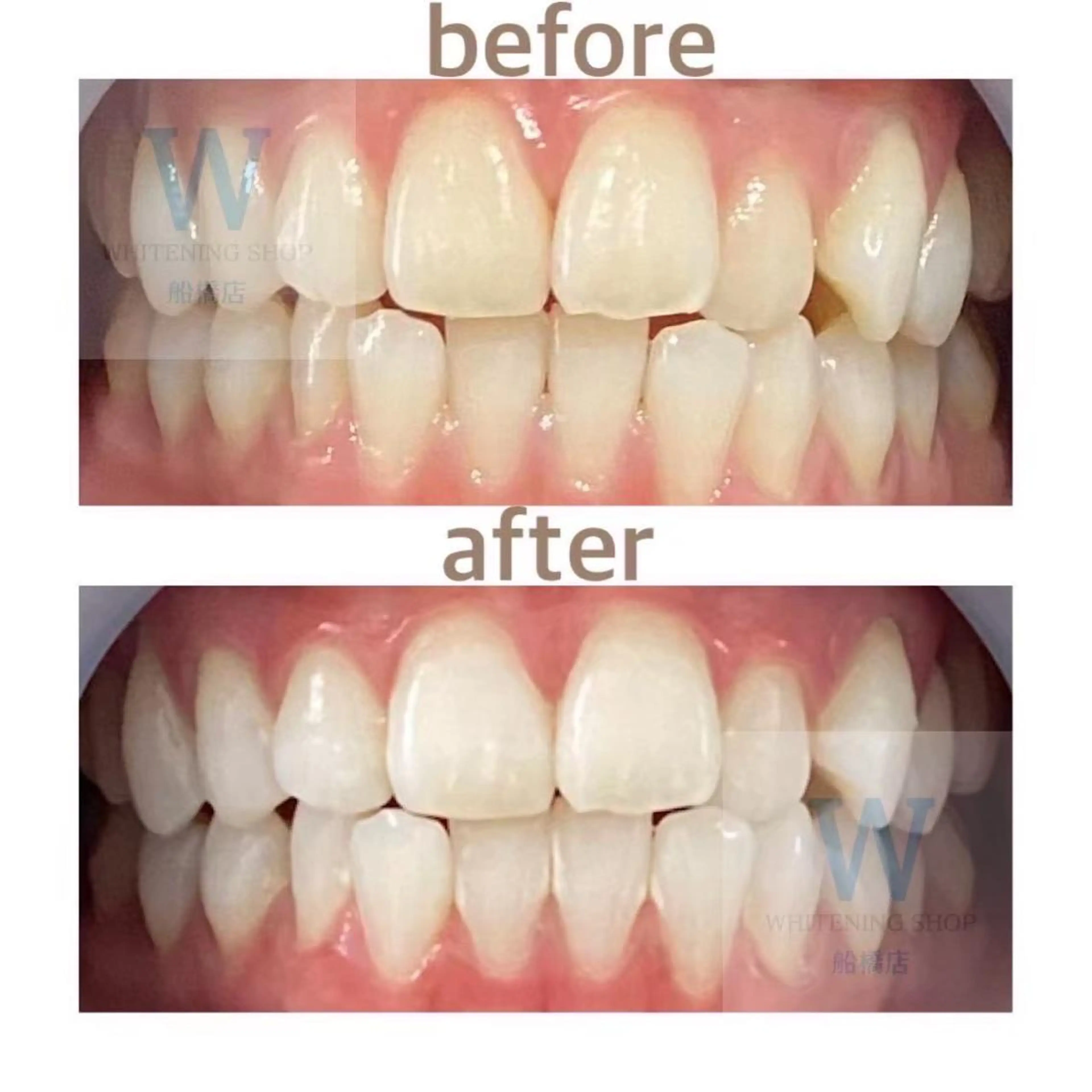 ホワイトニング ショップ船橋店🦷のエステ・リラクイメージ