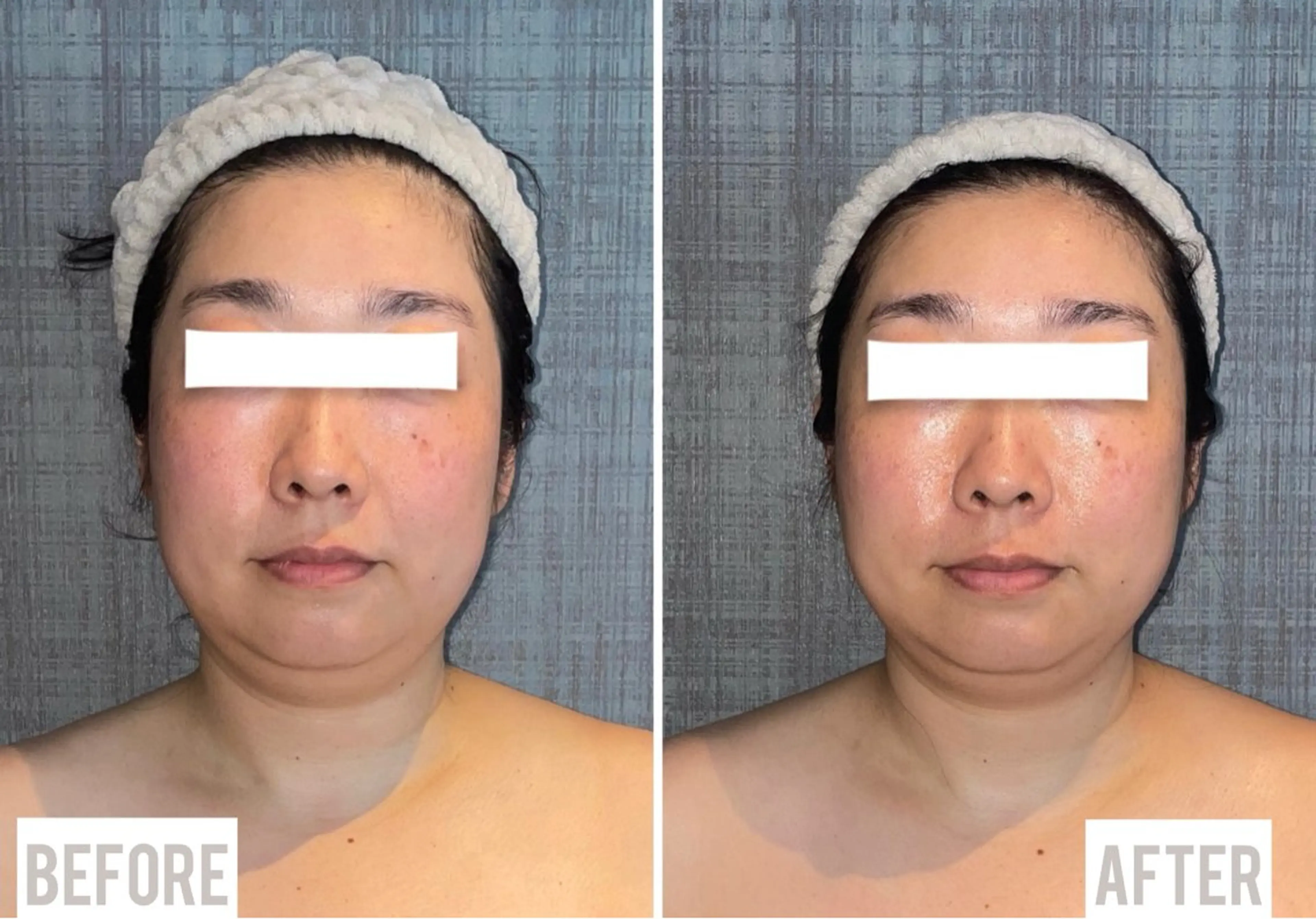 エステ リラク こりとりコルギ専門店MIICO所属・こりとりコルギ専門店 勝　友里奈のエステ・リラクイメージ