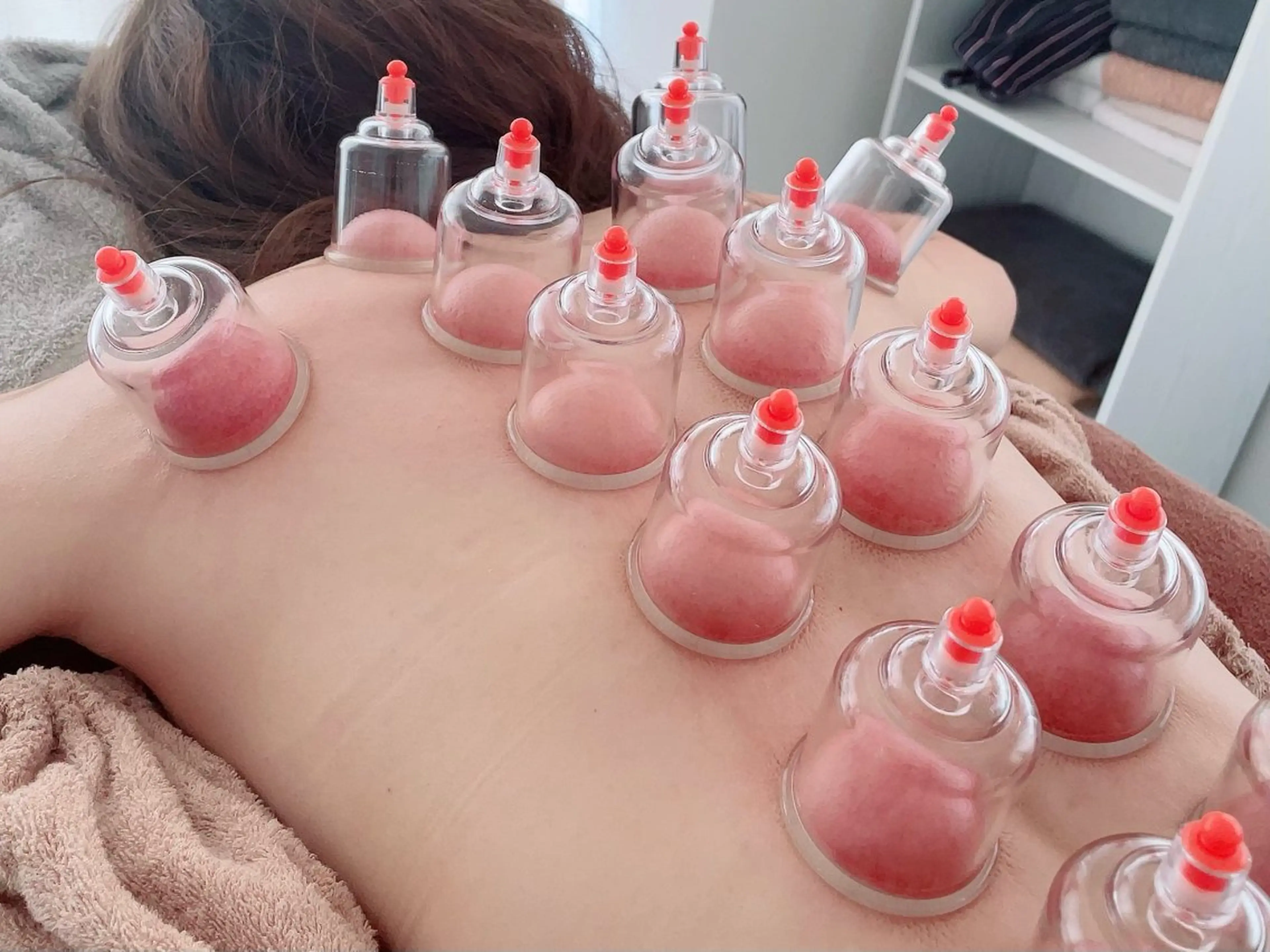 【むくみ撃退‼️】足と背中のスッキリカッピング（吸玉）⭐️の写真