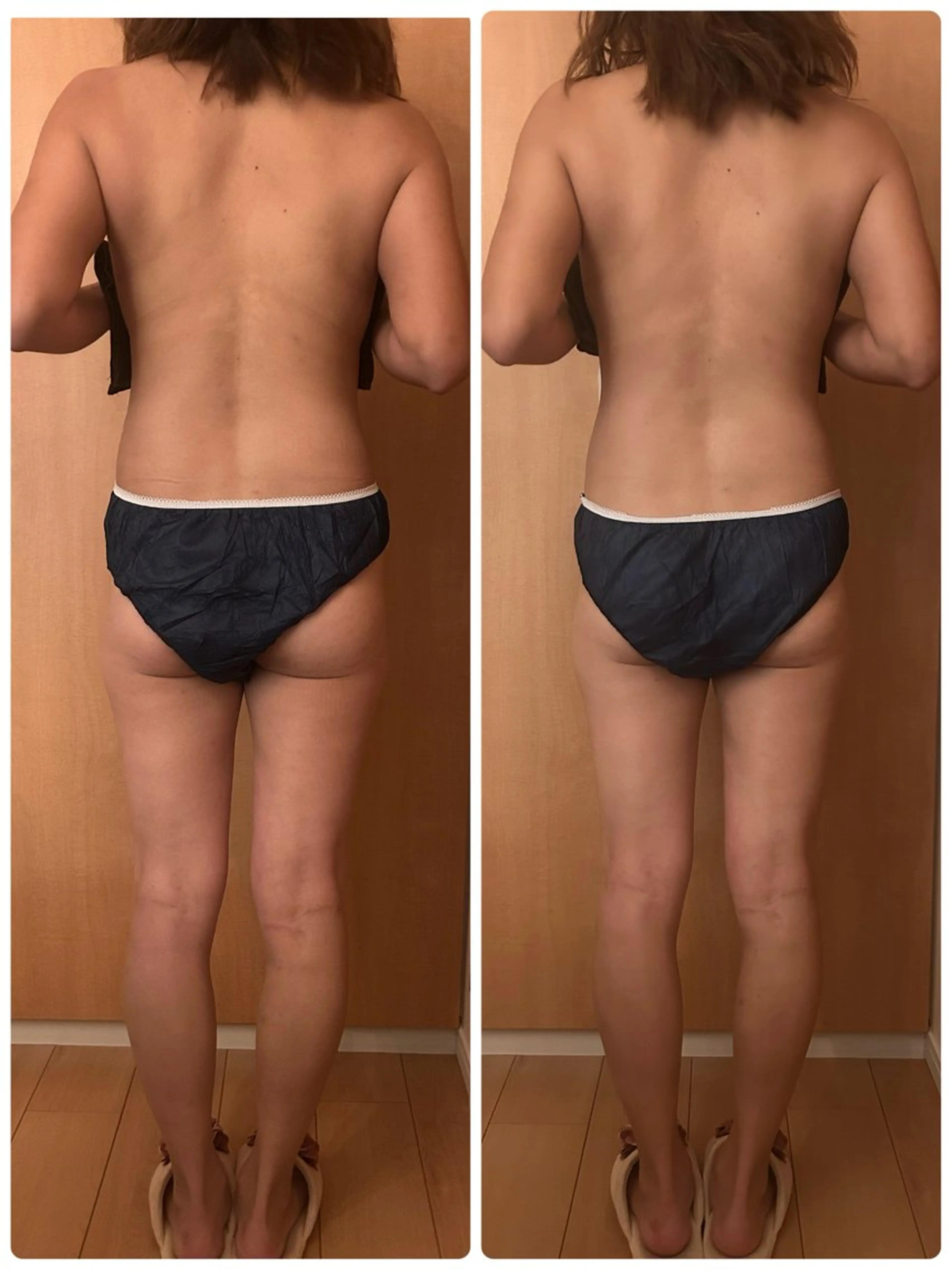 エステ リラク カイロプラクティック For Meのその他イメージ