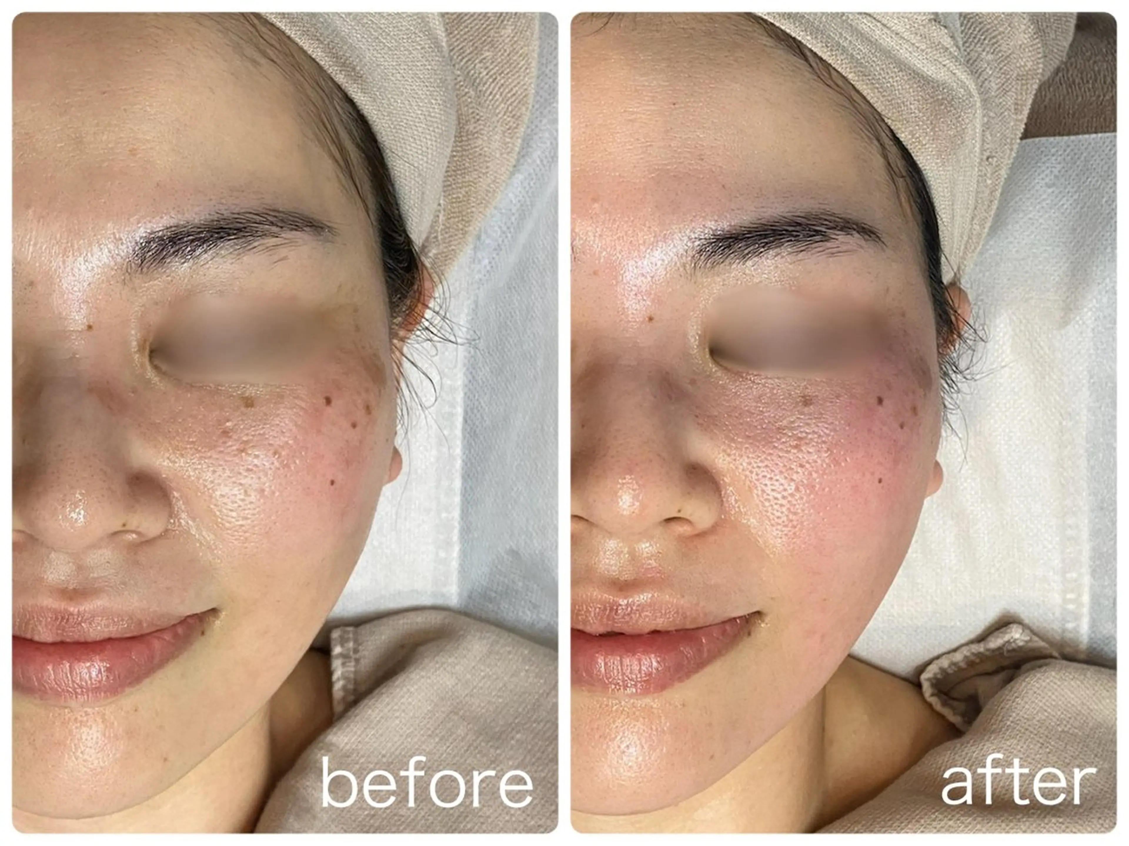 エステ Hisui 小出のエステ・リラクイメージ