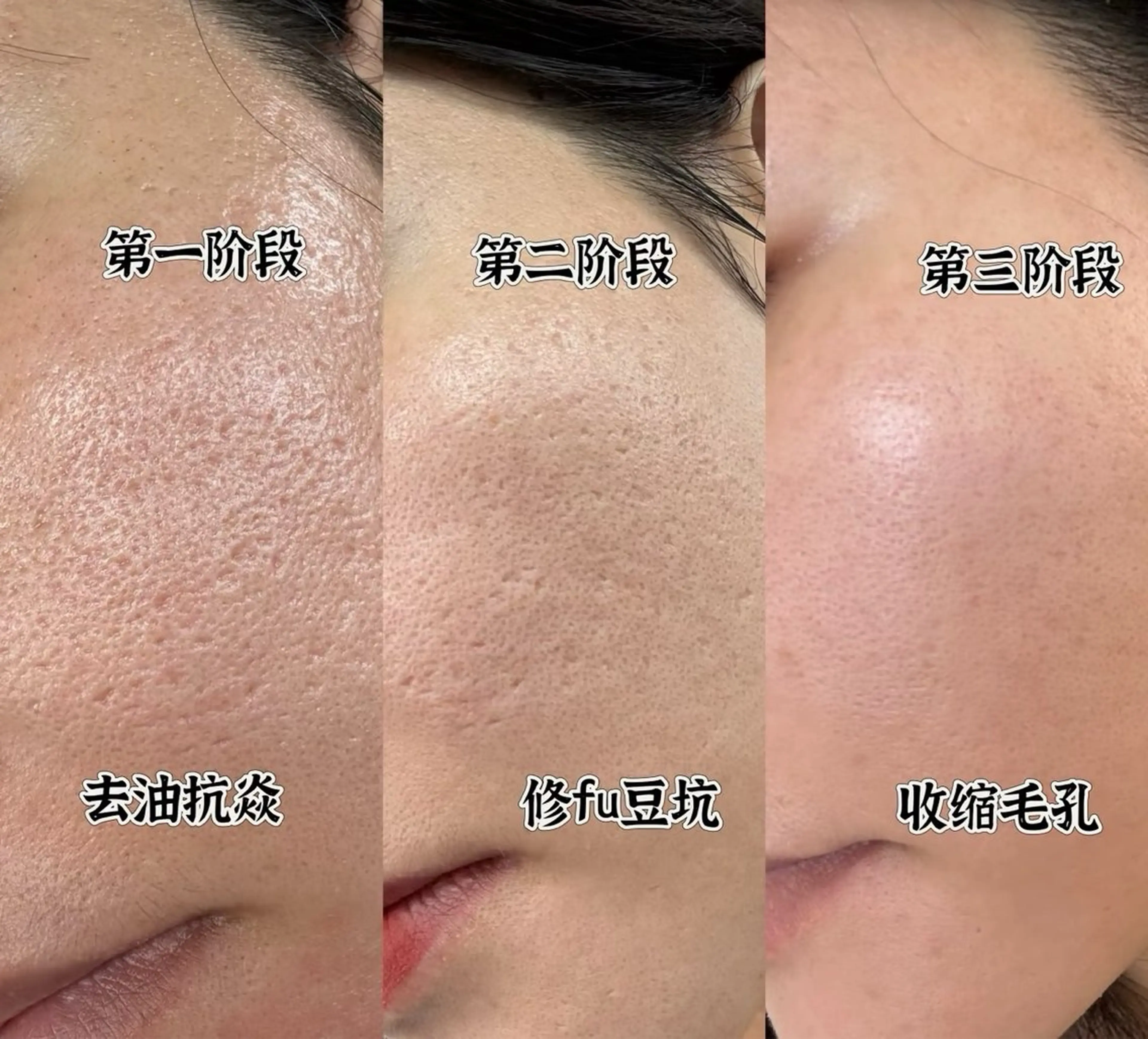 マツエク・マツパ エステ 愛維美水光美肌専門店 メンズレディースokのエステ・リラクイメージ