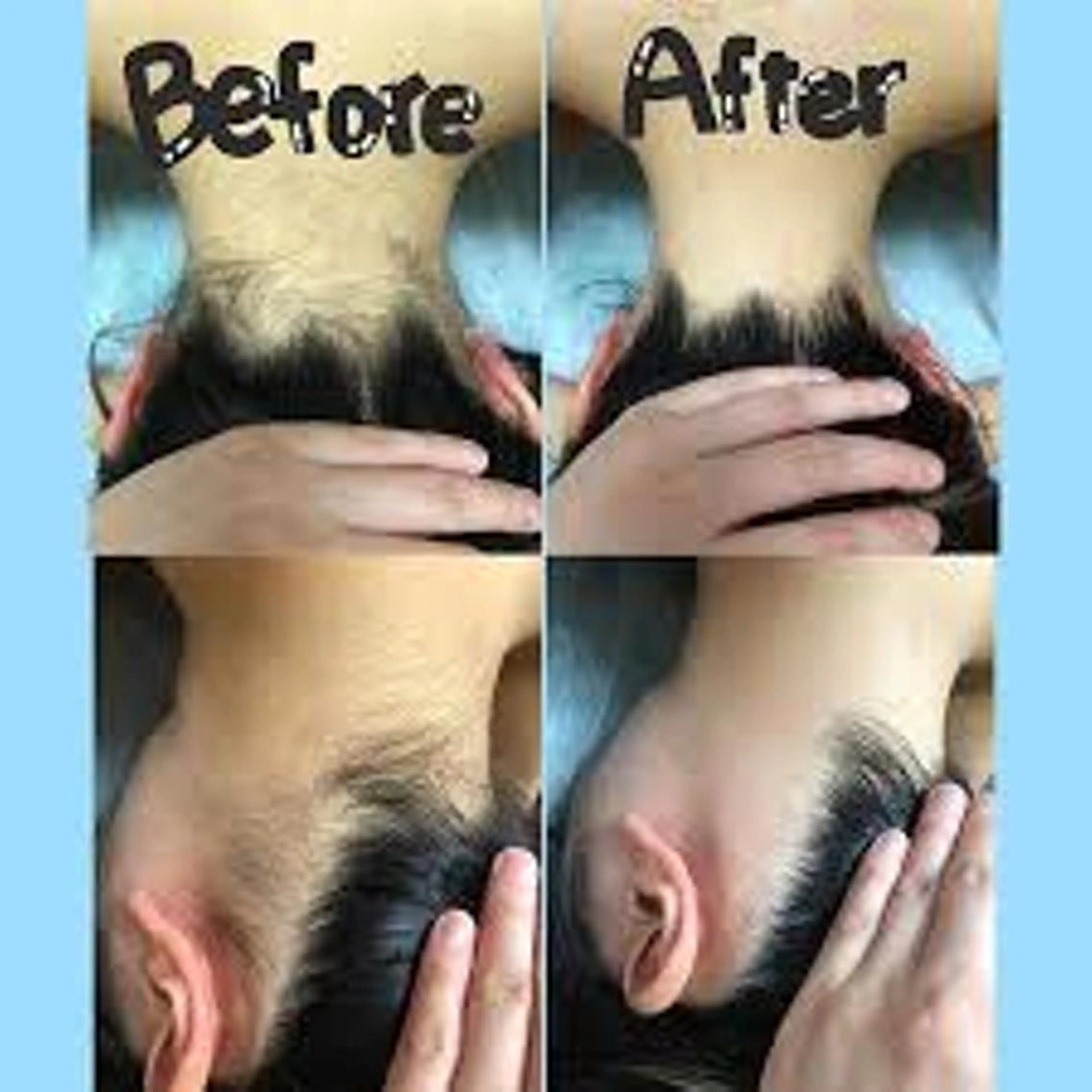 脱毛 RAYVIS梅田店 FUKUのエステ・リラクイメージ