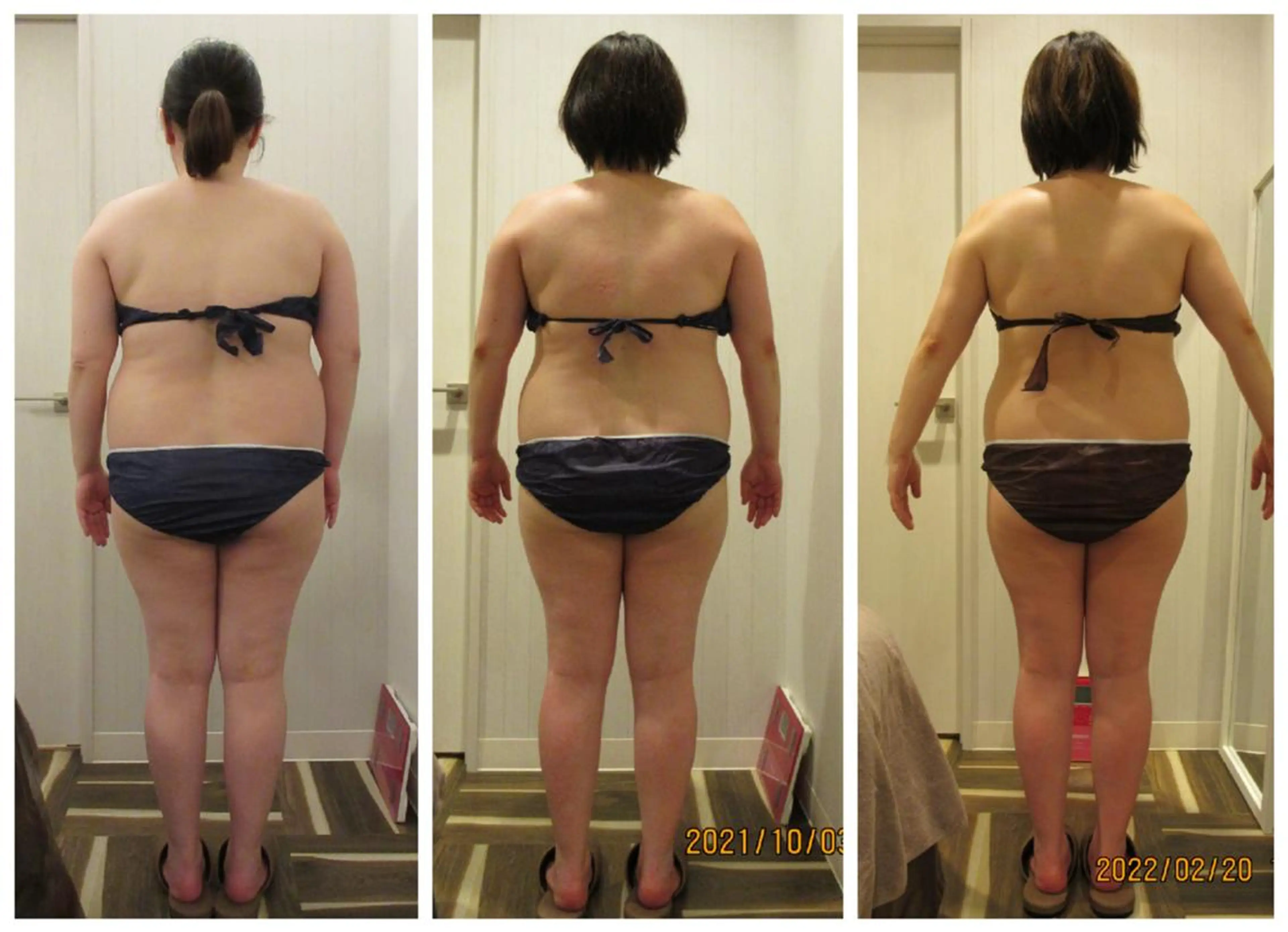 小顔専門店 グレイスボディ三郷店のエステ・リラクイメージ