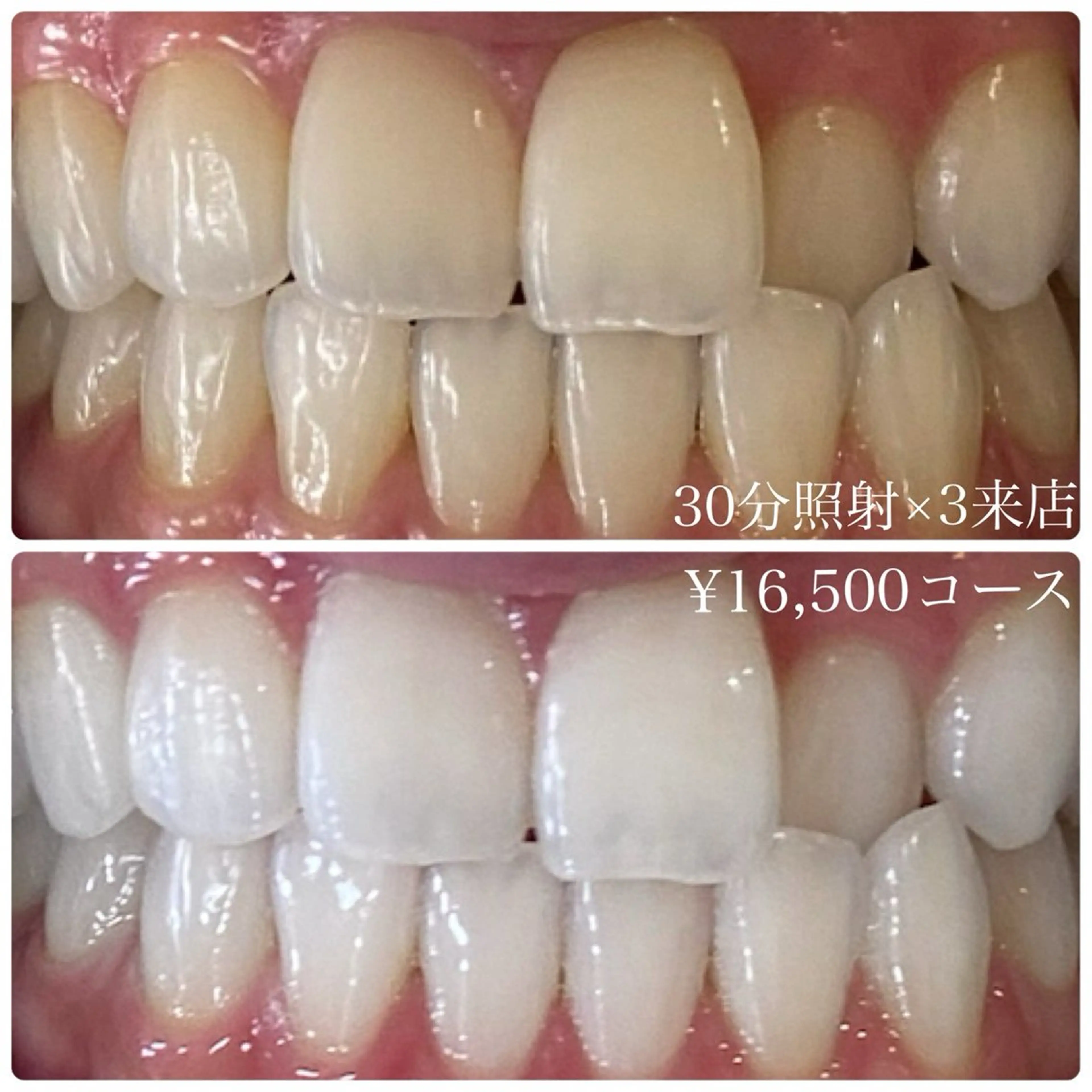 PLATINUM Beauty 横浜店所属・ホワイトニングルーム 横浜店のその他イメージ