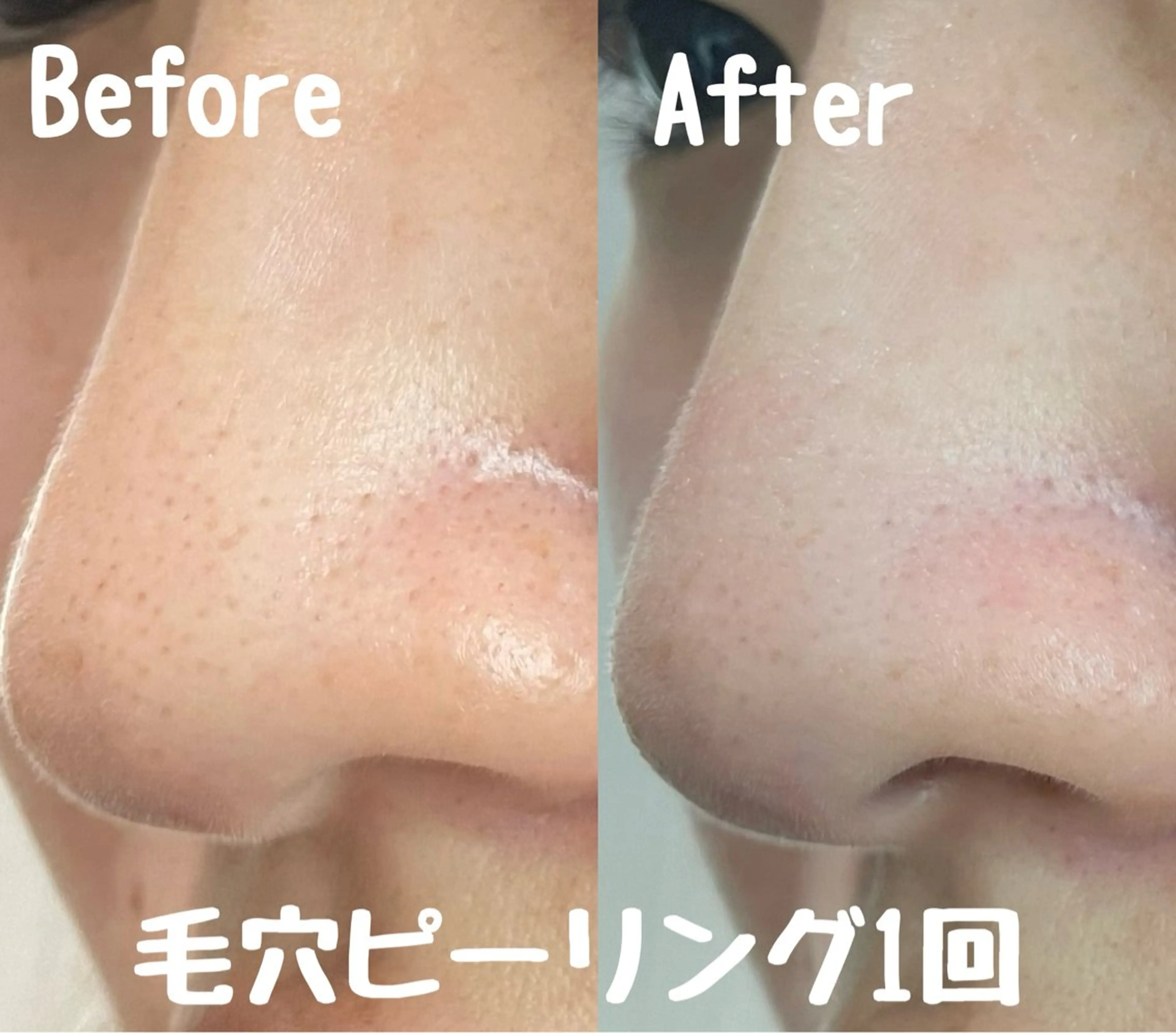 エステ リラク Surien 水脇ゆうのその他イメージ