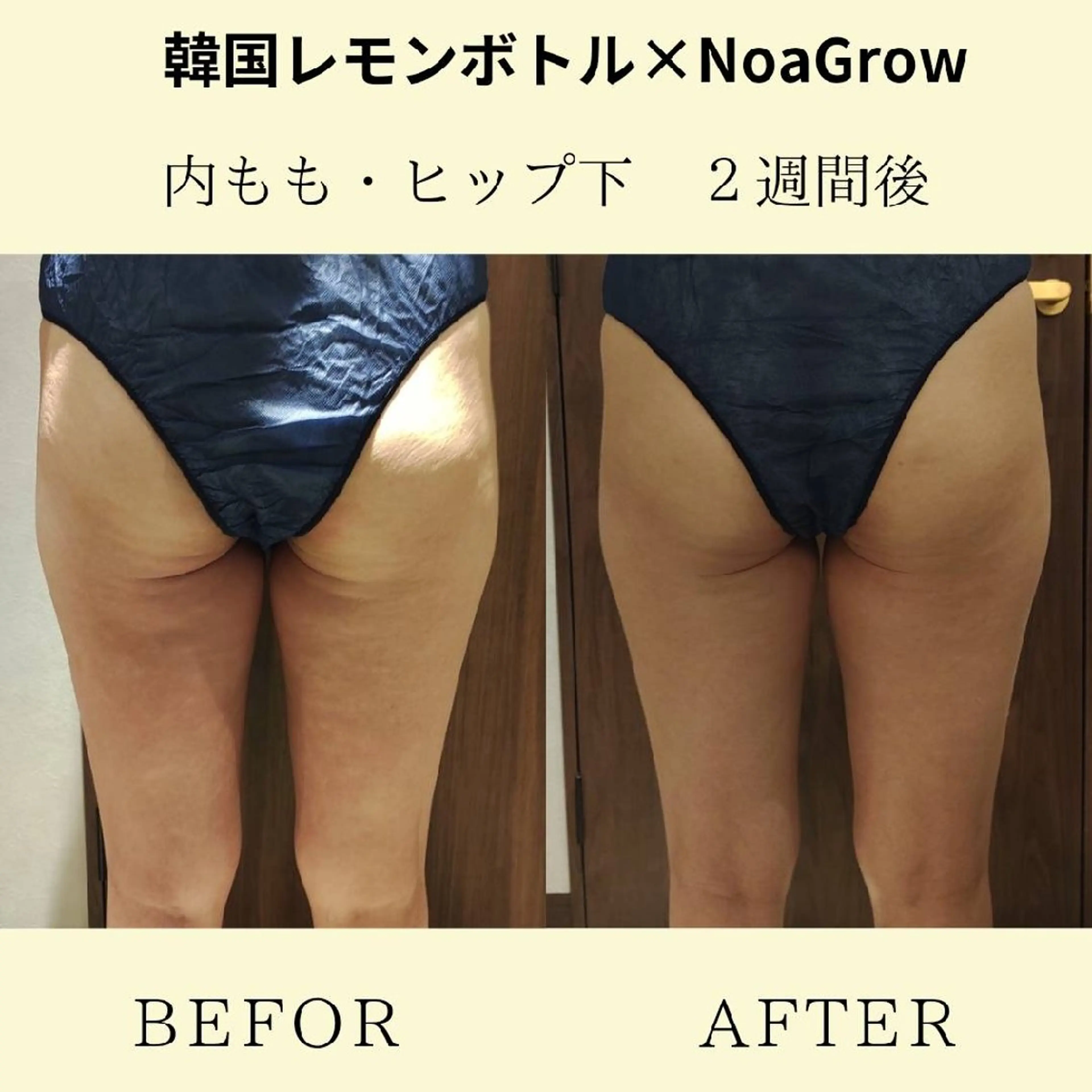 痩身小顔専門 アマテ ビューティー.Nのエステ・リラクイメージ