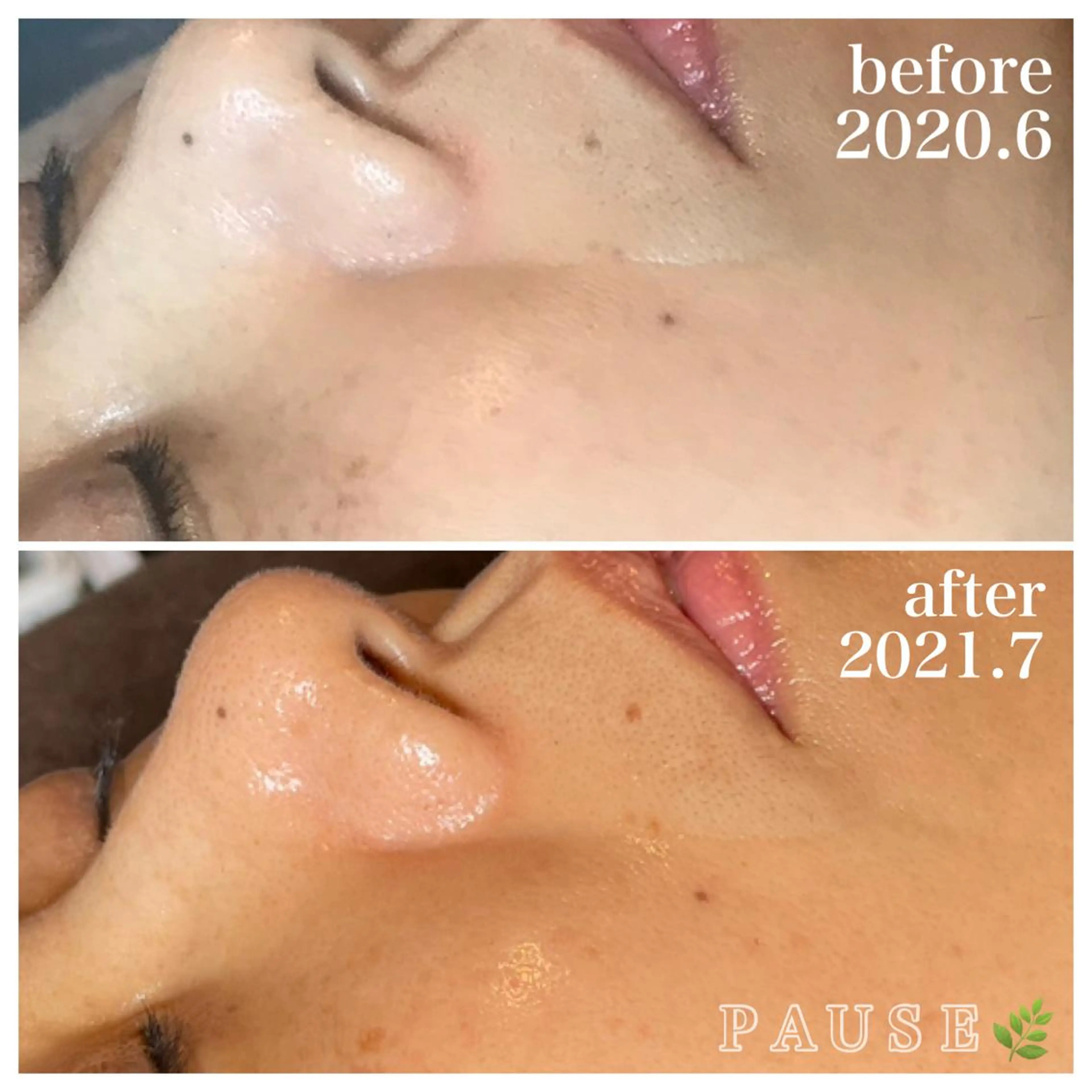 エステ 浜野 恵美のエステ・リラクイメージ