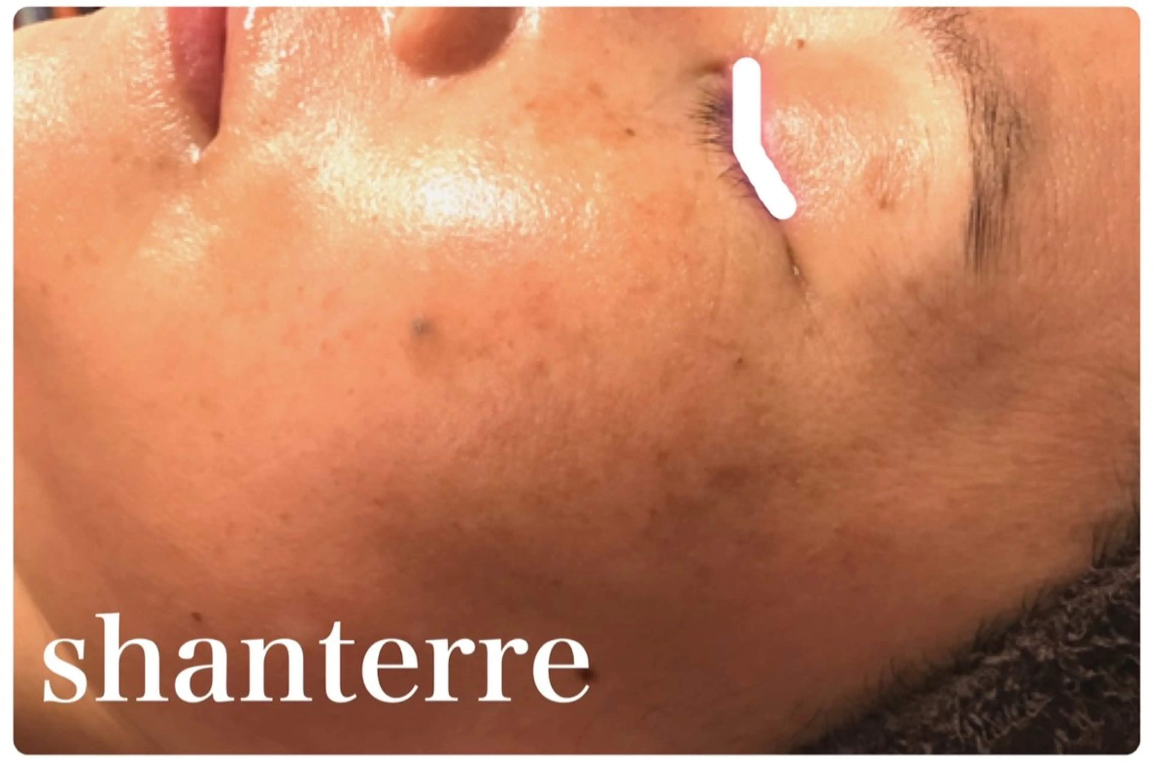 ピーリングサロン シャンテールのエステ・リラクイメージ