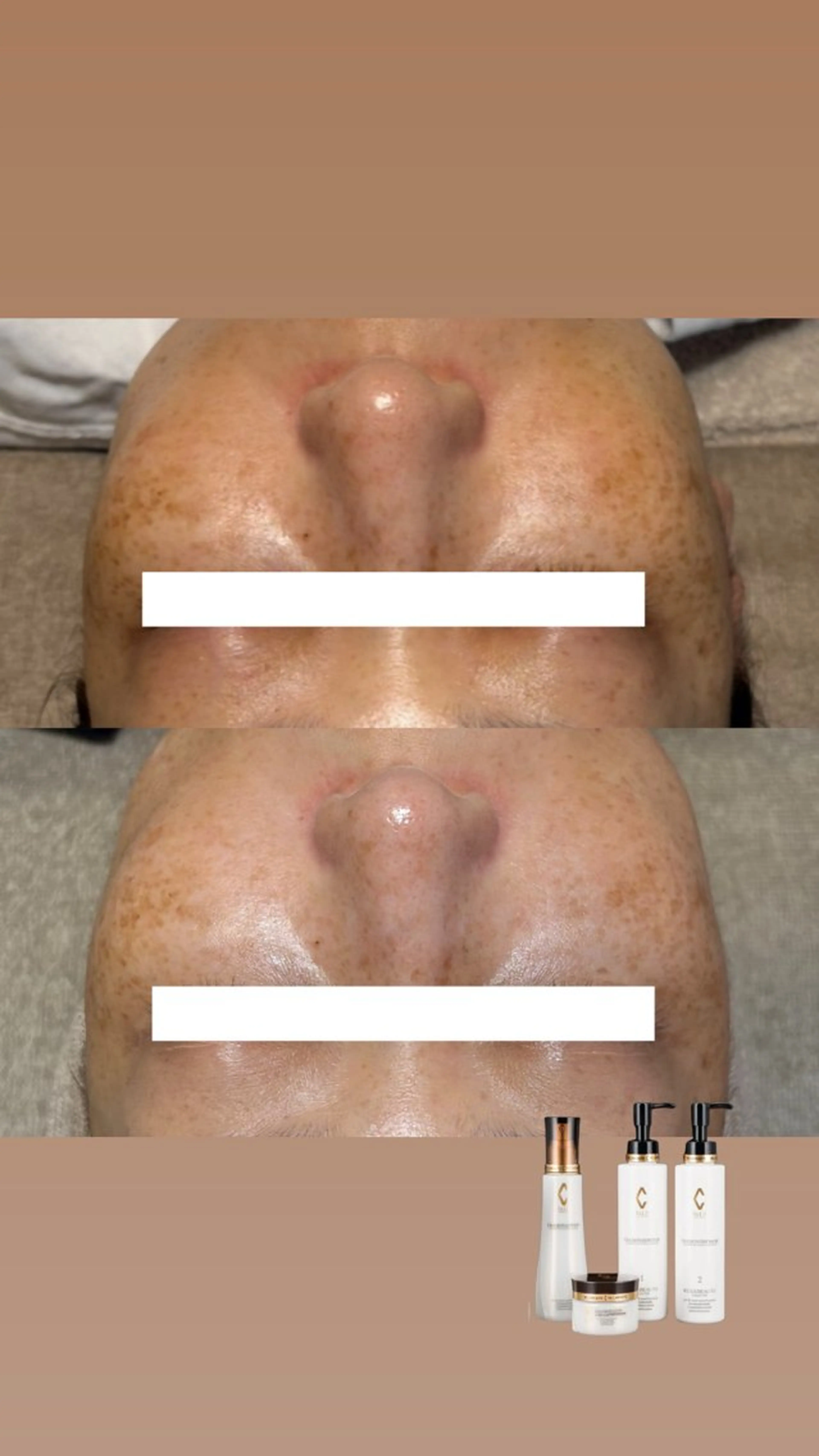 エステ Lassy Yuriの眉毛・アイブロウイメージ