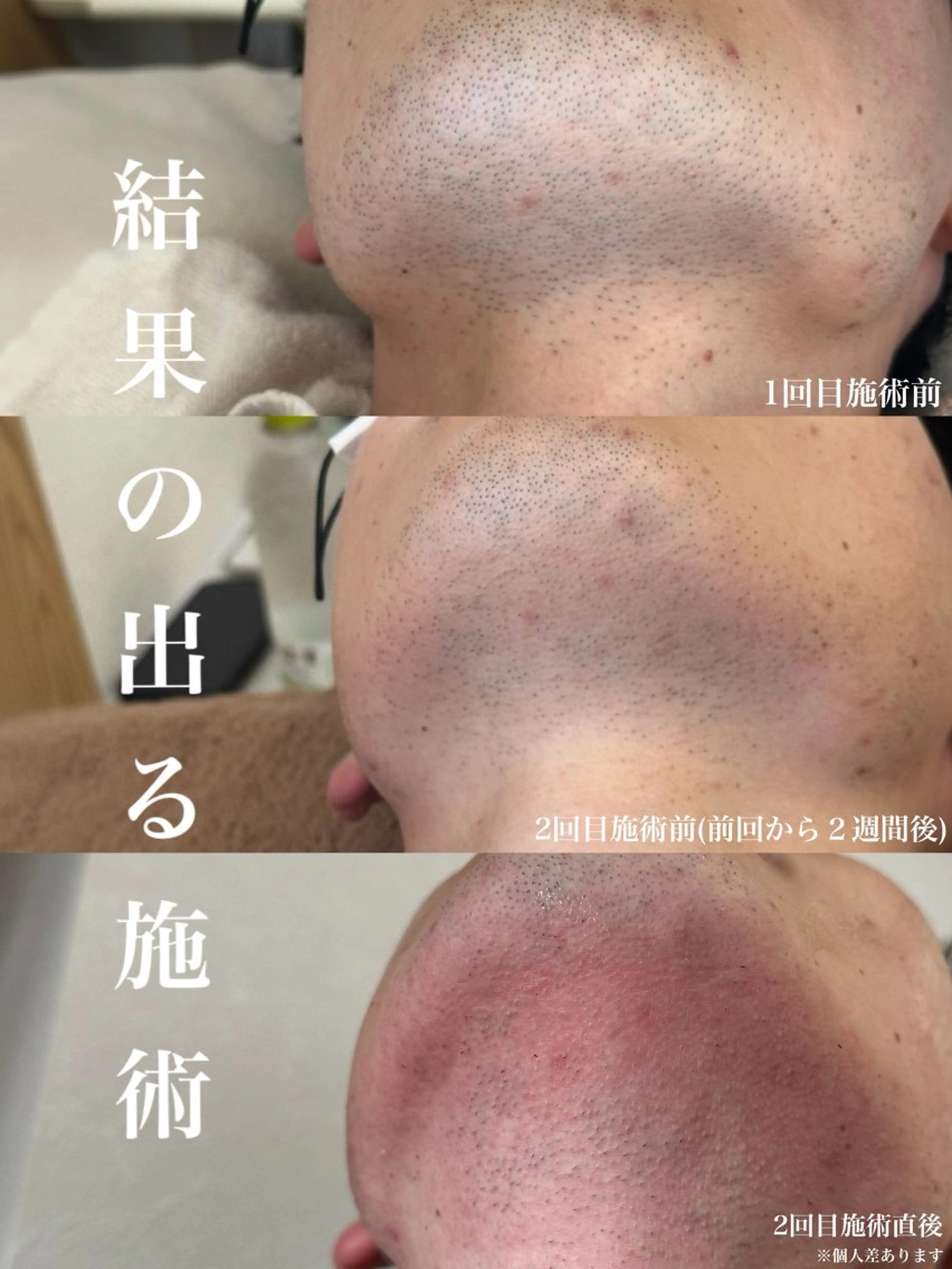 メンズ muumo まりののエステ・リラクイメージ