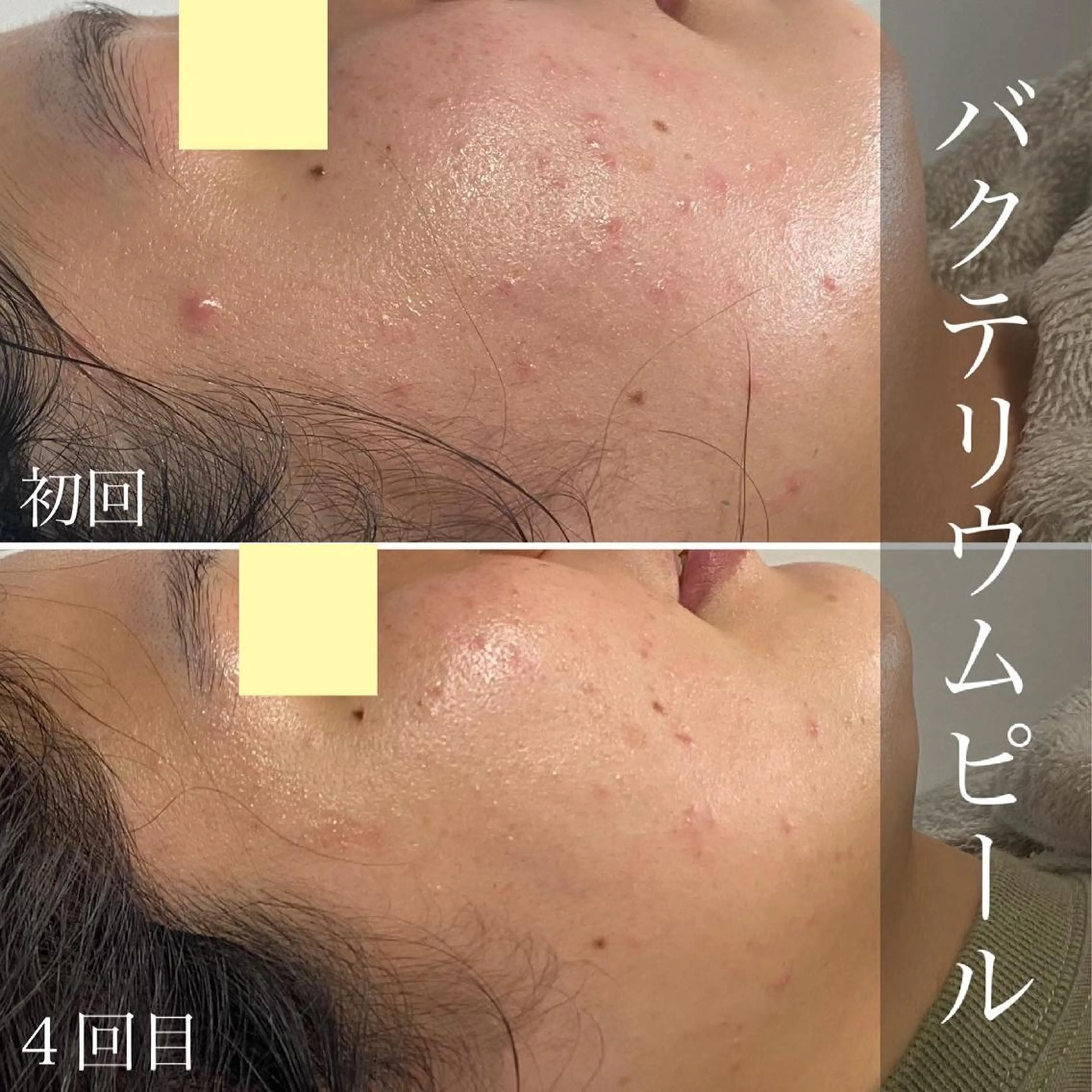 メンズ歓迎🙆‍♀️ エステ/ネイルISTのネイルデザイン