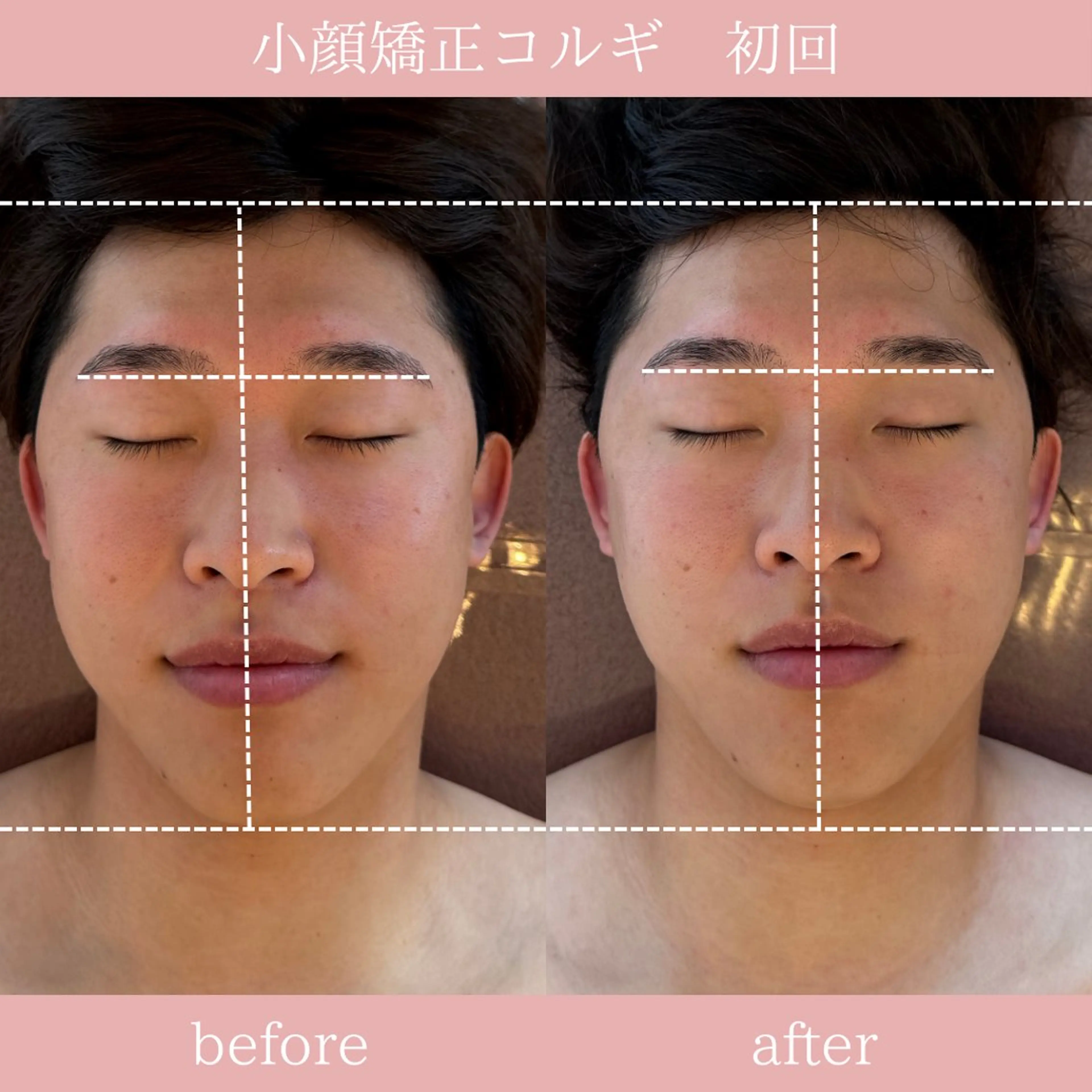 エステ 眉毛/小顔/ハーブ 🌼hikaruの眉毛・アイブロウイメージ