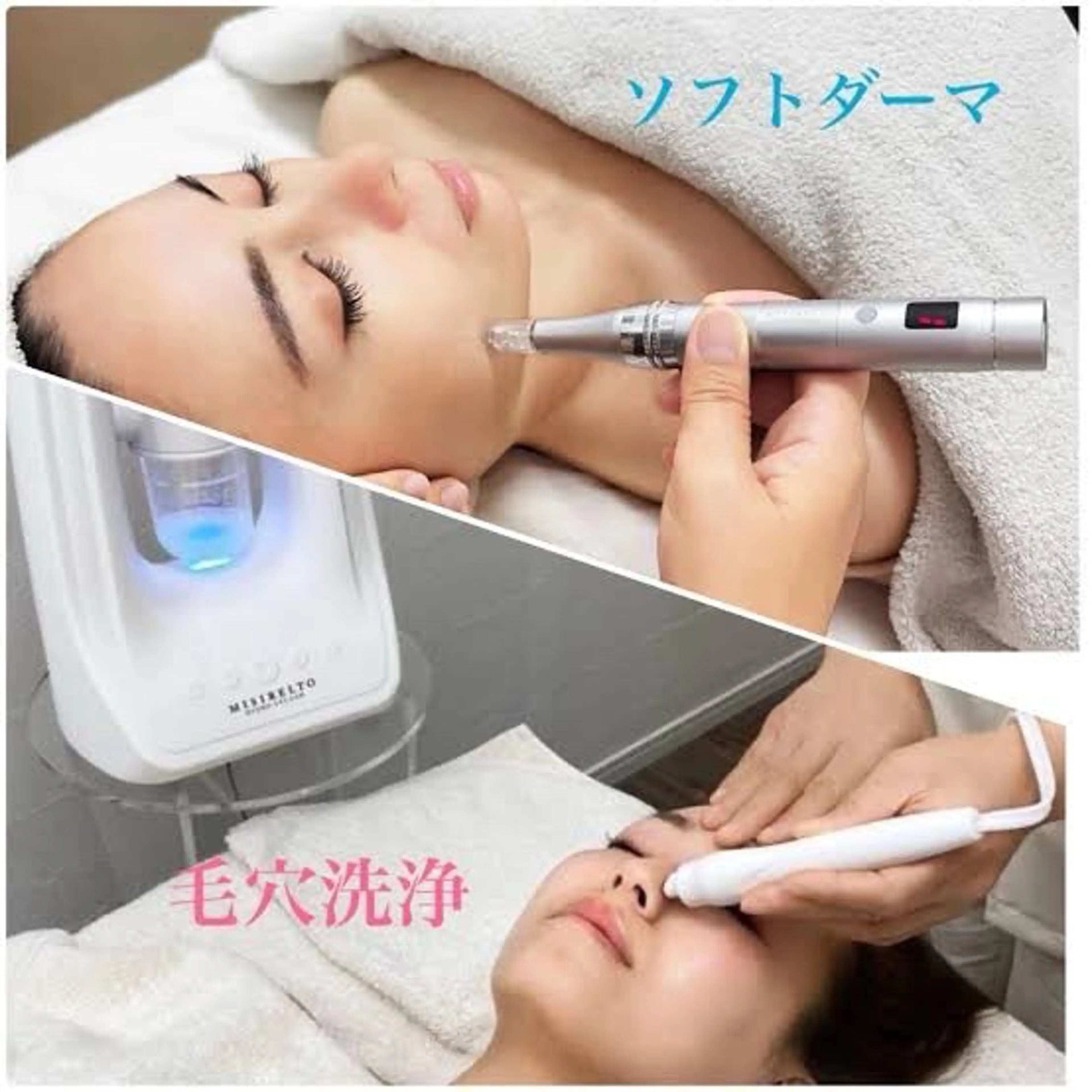 【水光肌】ソフトダーマ×塗るボトックスの写真