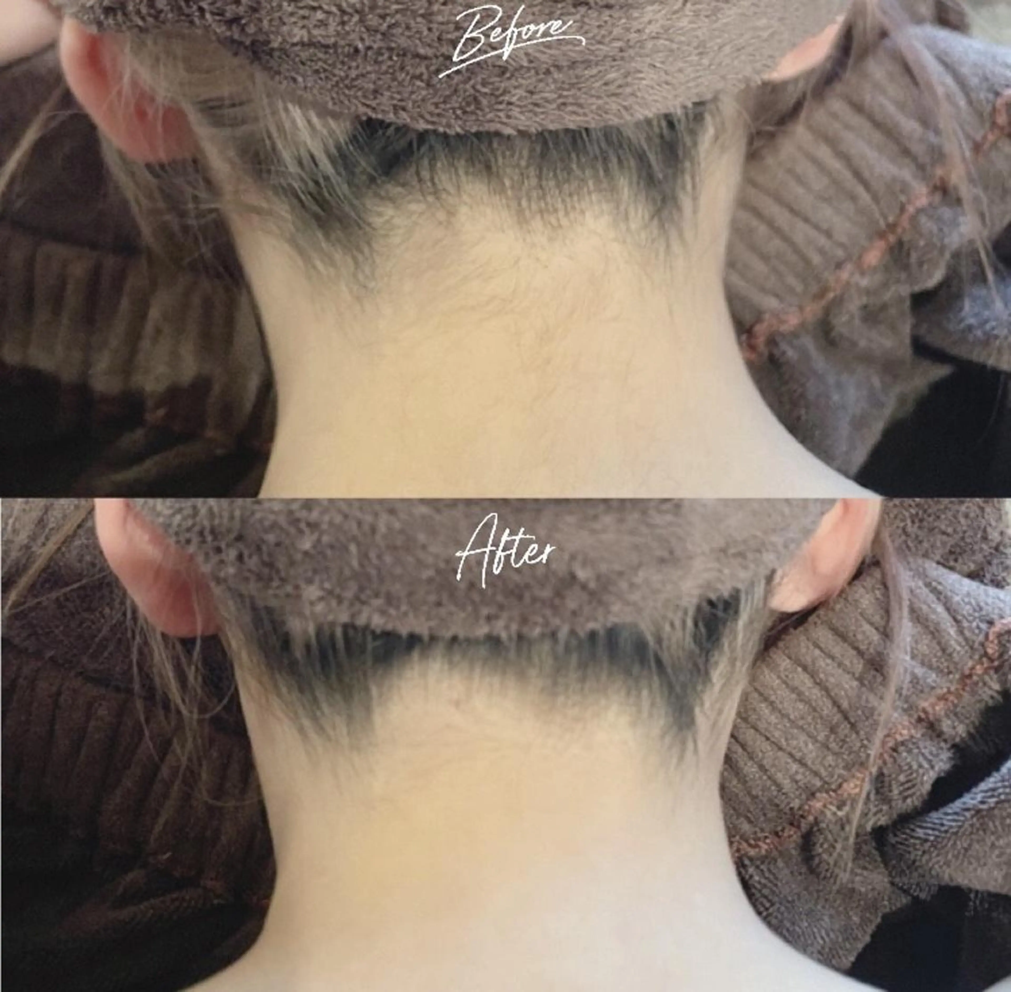 美肌脱毛/肌質改善 《ulula~梟》のエステ・リラクイメージ