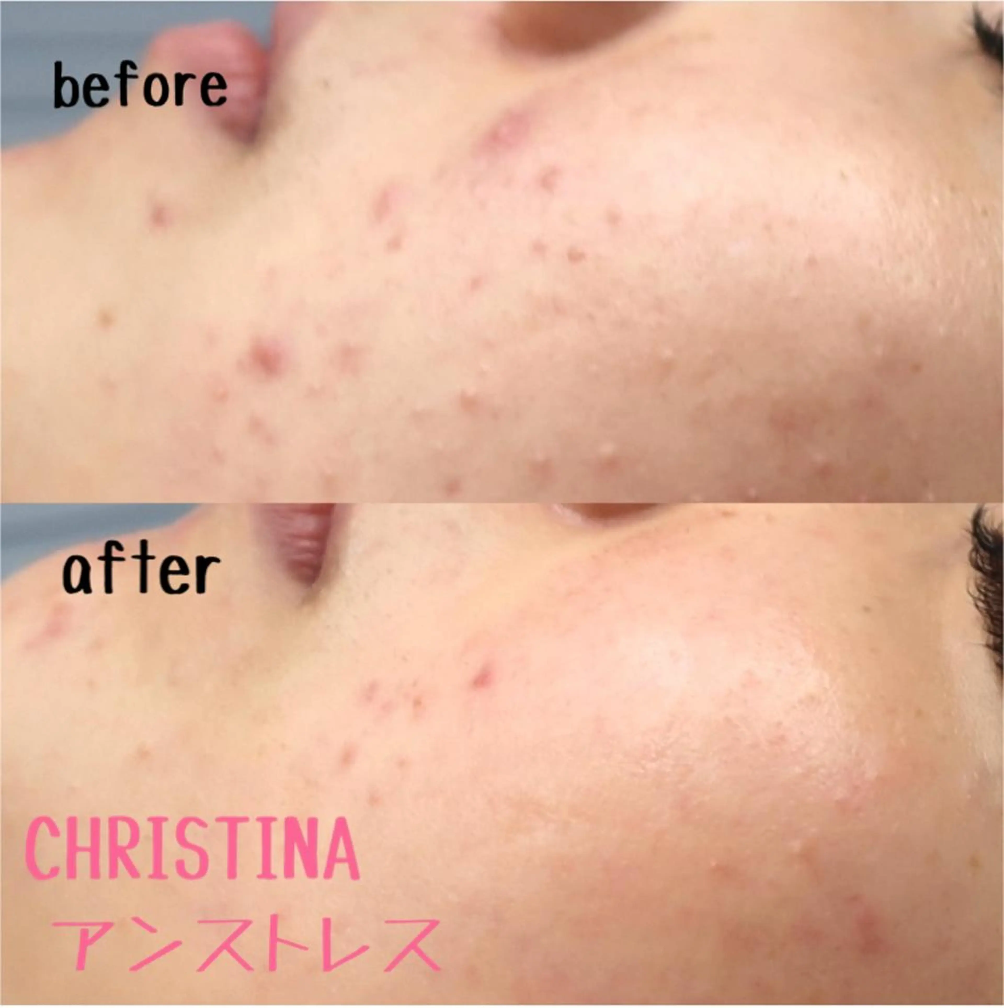 肌質改善サロンChouChou所属・肌質改善サロン chouchouのエステ・リラクイメージ